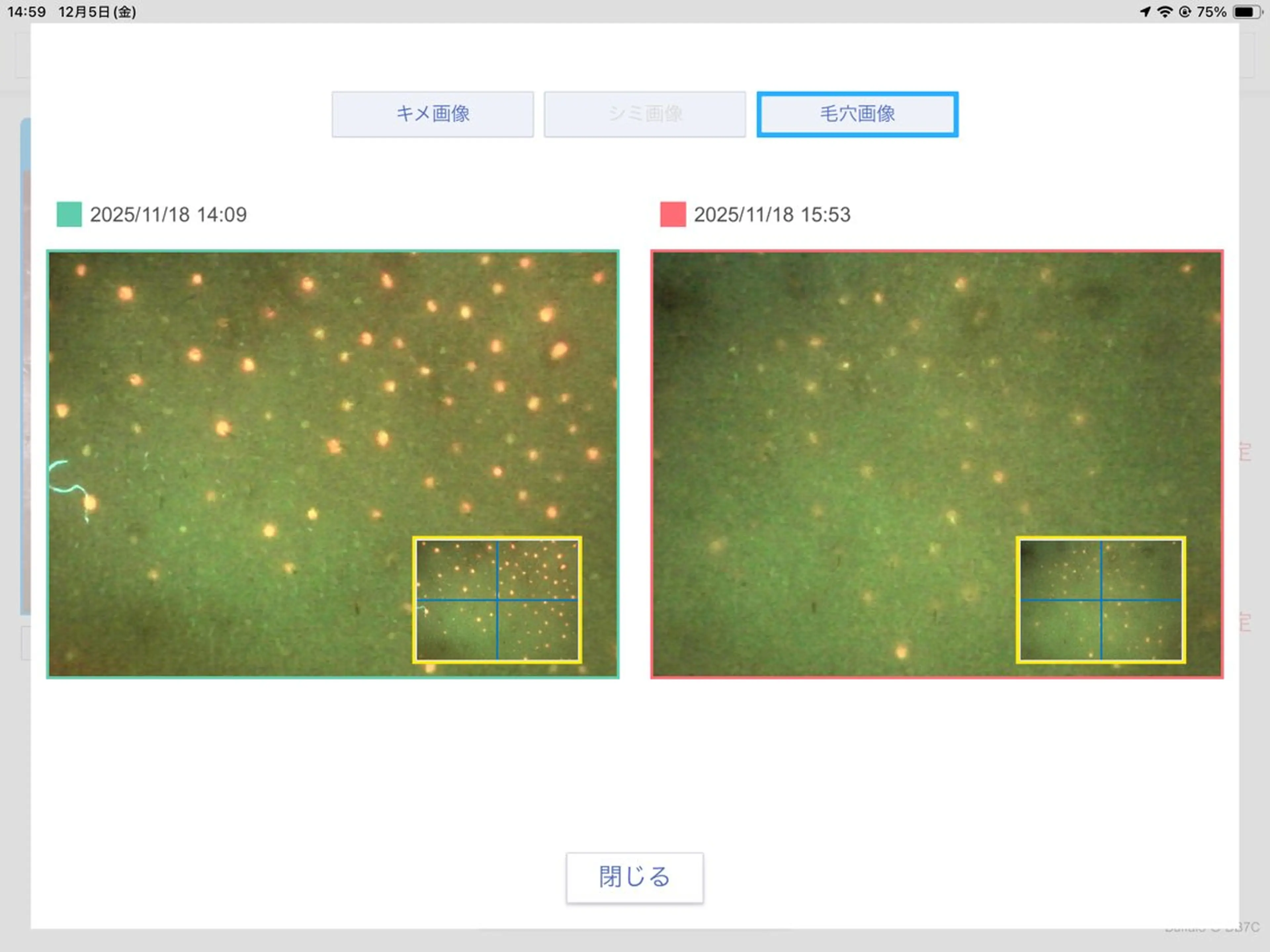エステ 毛穴専門店Bébéもりの里店所属・毛穴専門店Bébé もりの里店のエステ・リラクイメージ