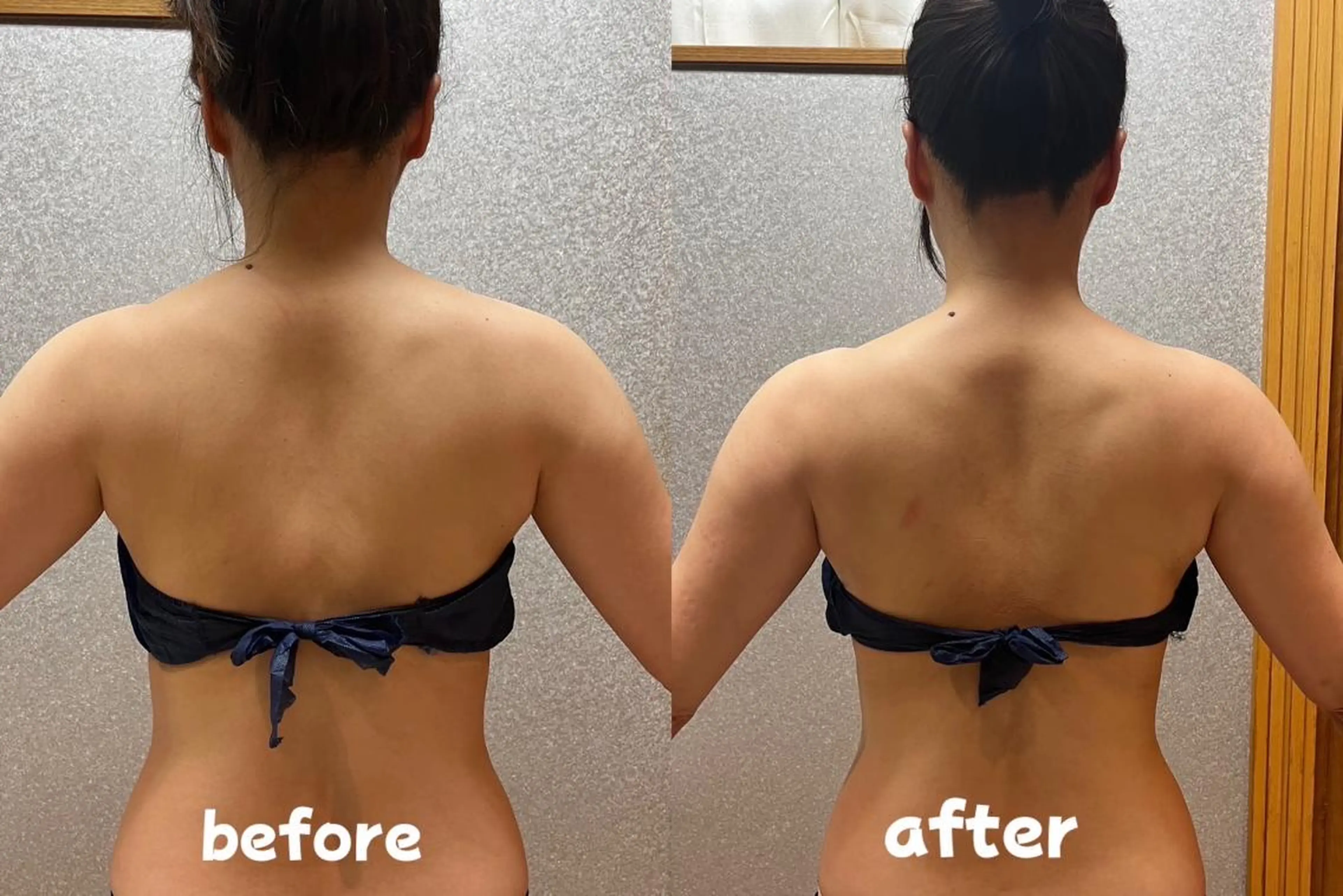 上半身集中 サイズダウン(肩、二の腕、お腹、背中) 45分の写真