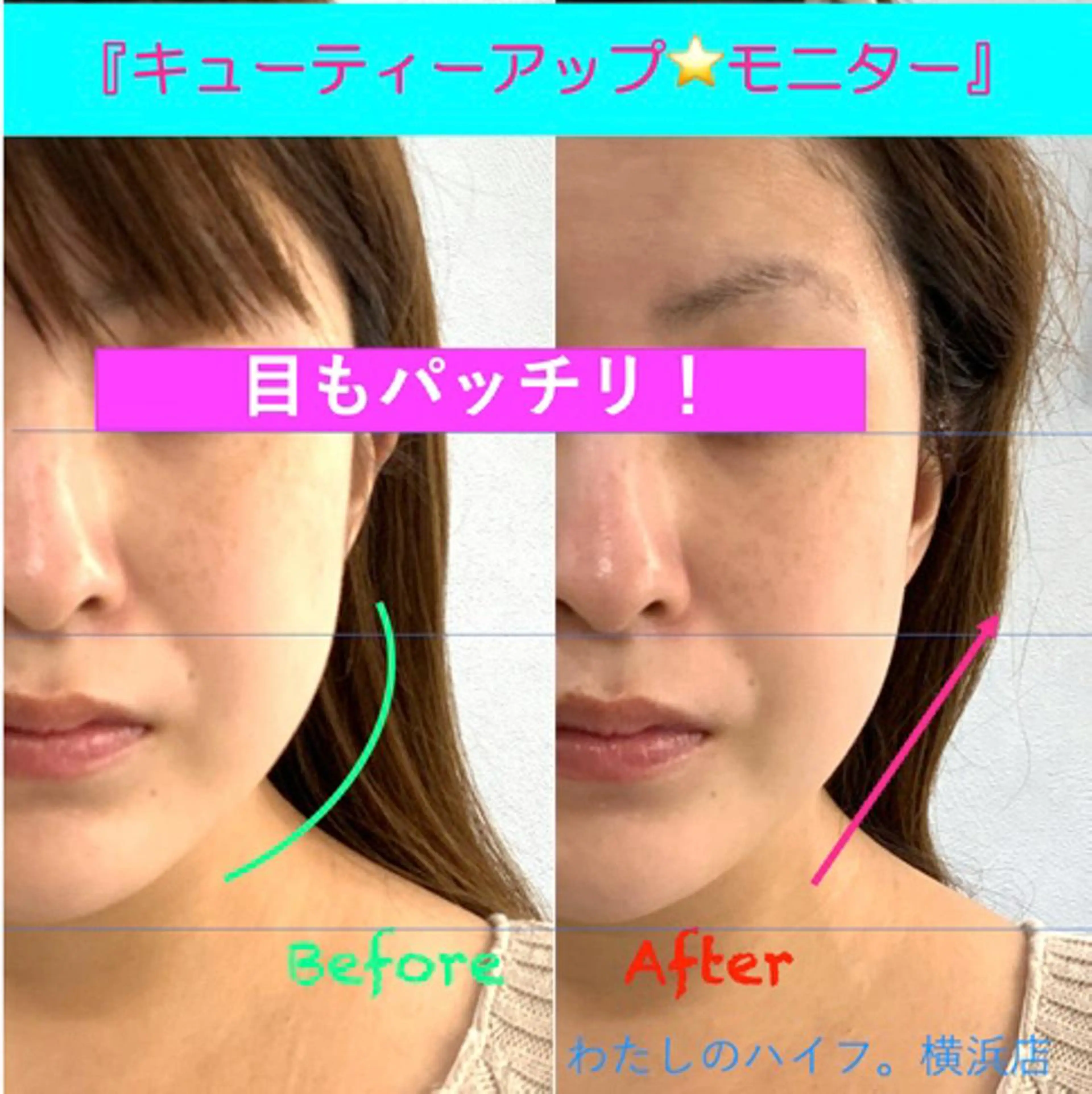 小顔美肌&痩身ｻﾛﾝ My Timeのエステ・リラクイメージ