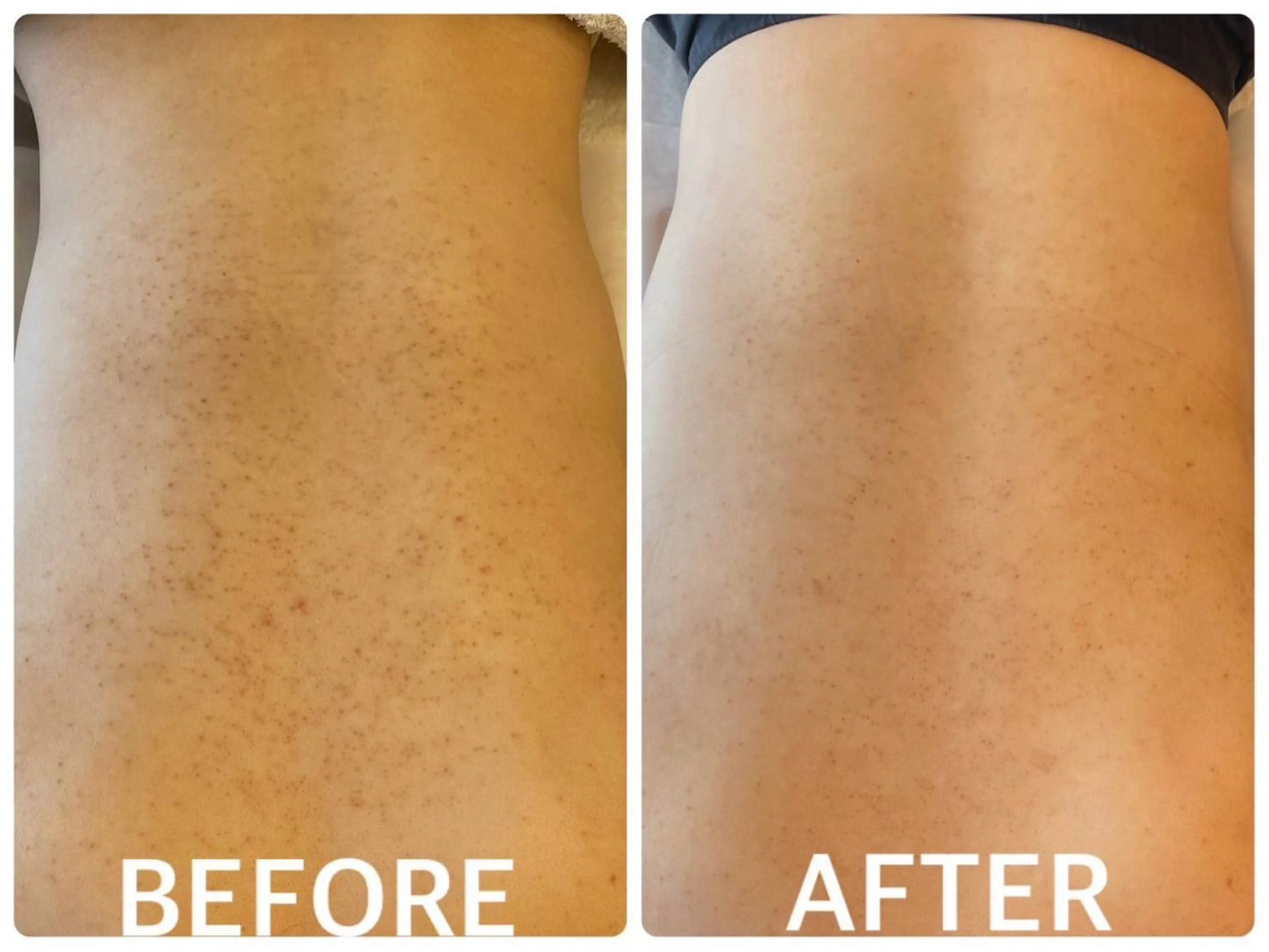 ハーブピーリング 🌿京橋のエステ・リラクイメージ