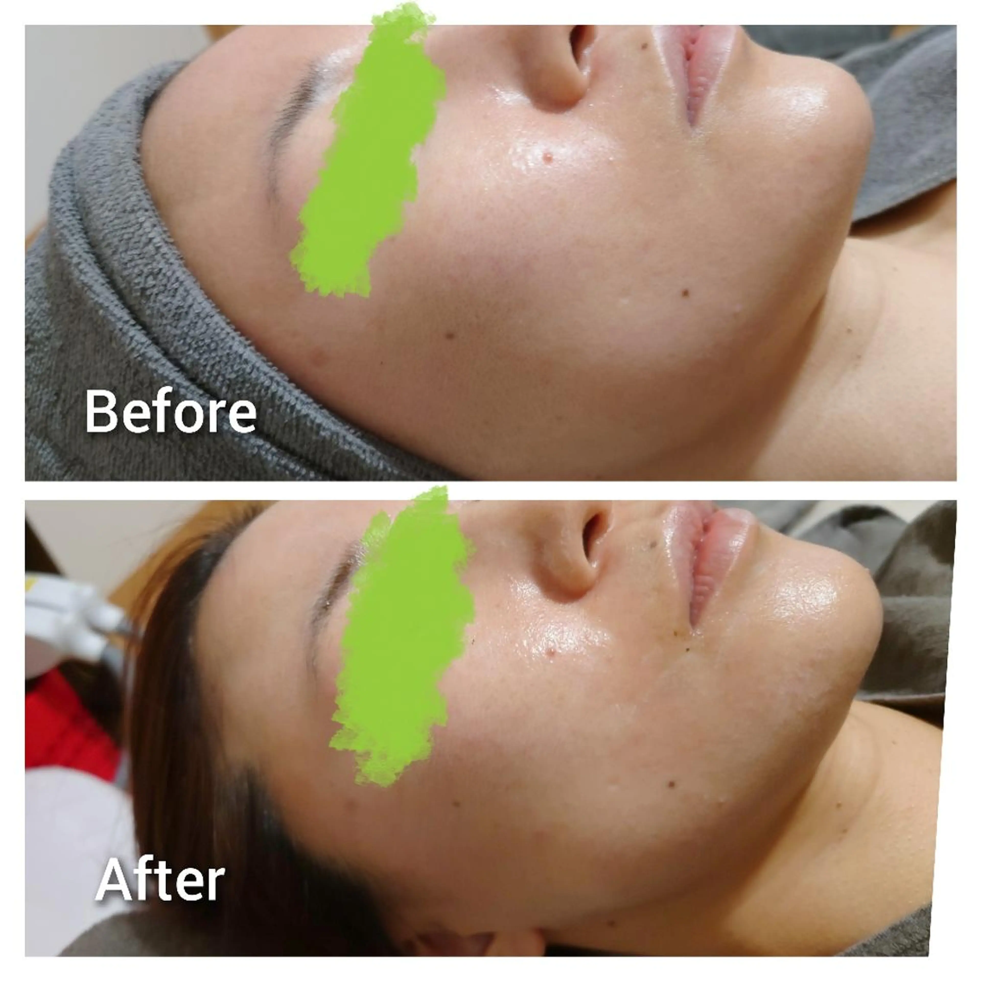 エステ Beauty Salon Luana所属・Luanaまつパ脱毛 ハーブピーリング眉毛のマツエク・マツパデザイン