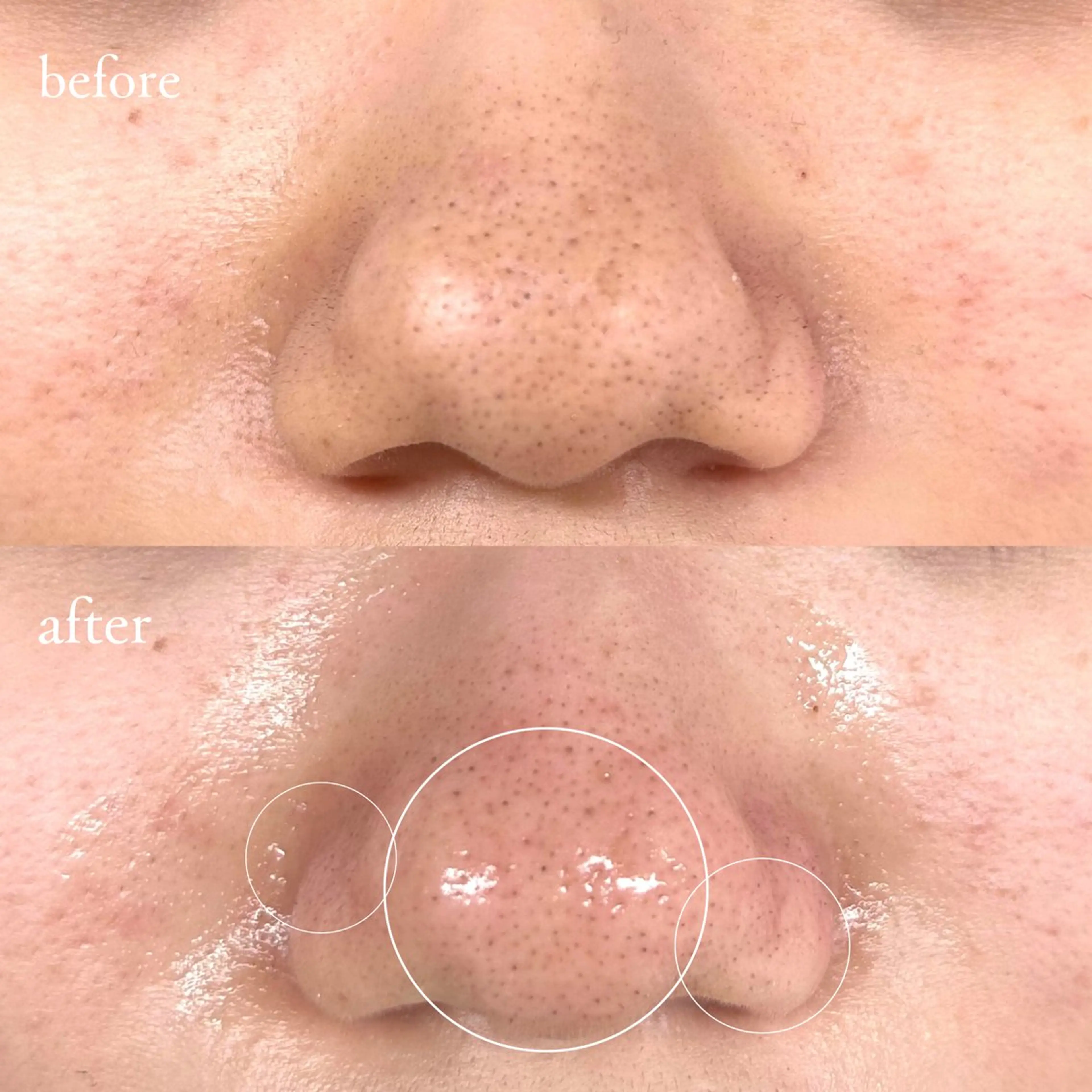 アイブロウ 眉毛ワックス脱毛 アイブロウサロンTreat myself所属・Treat myselfの眉毛・アイブロウイメージ