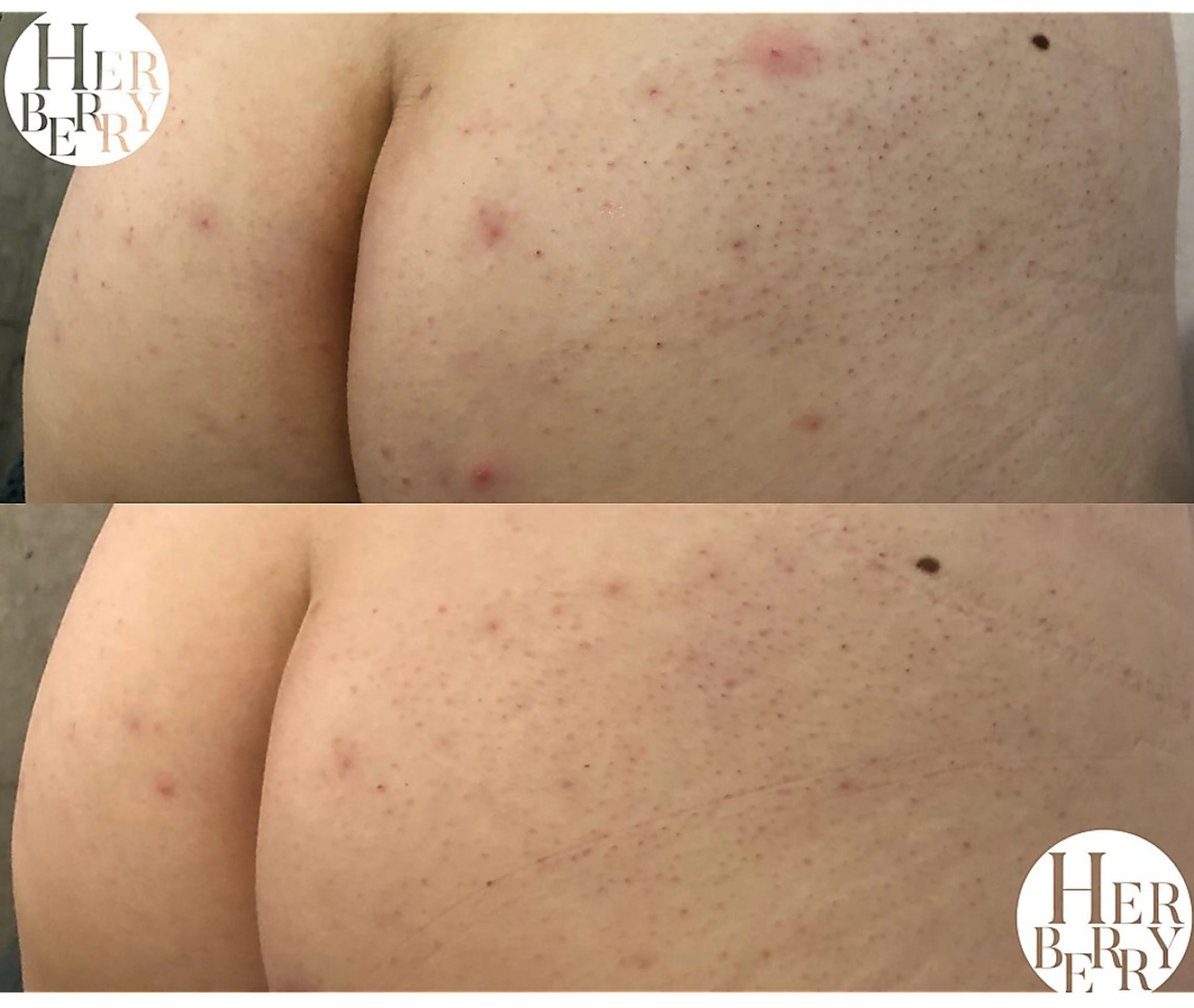 ハーブピーリング専門店HERBERRY難波心斎橋店所属・ハーブピーリング専門 HERBERRY冨永のエステ・リラクイメージ