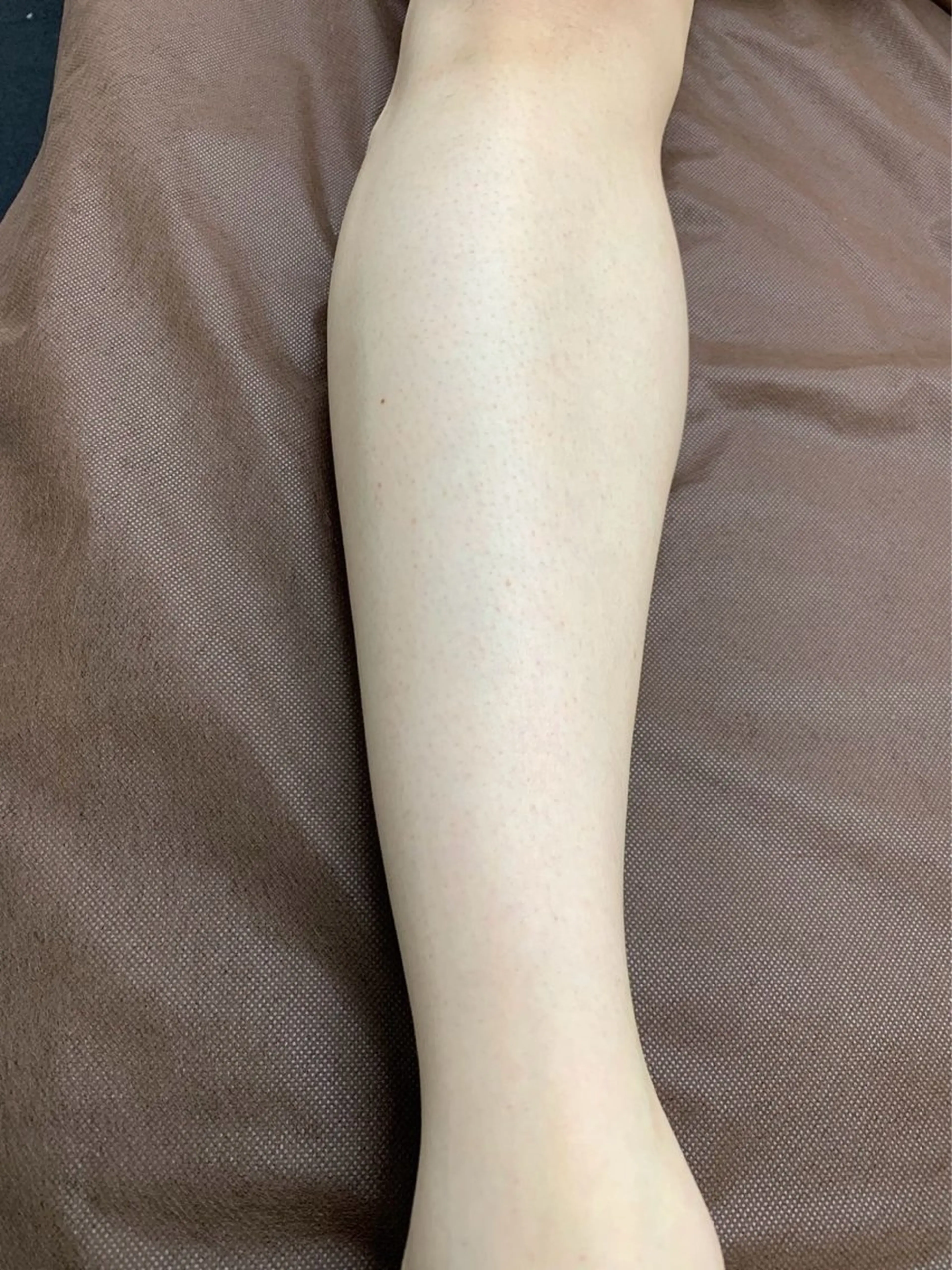 メンズ 脱毛 脱毛サロン BRIDGE橋本のエステ・リラクイメージ