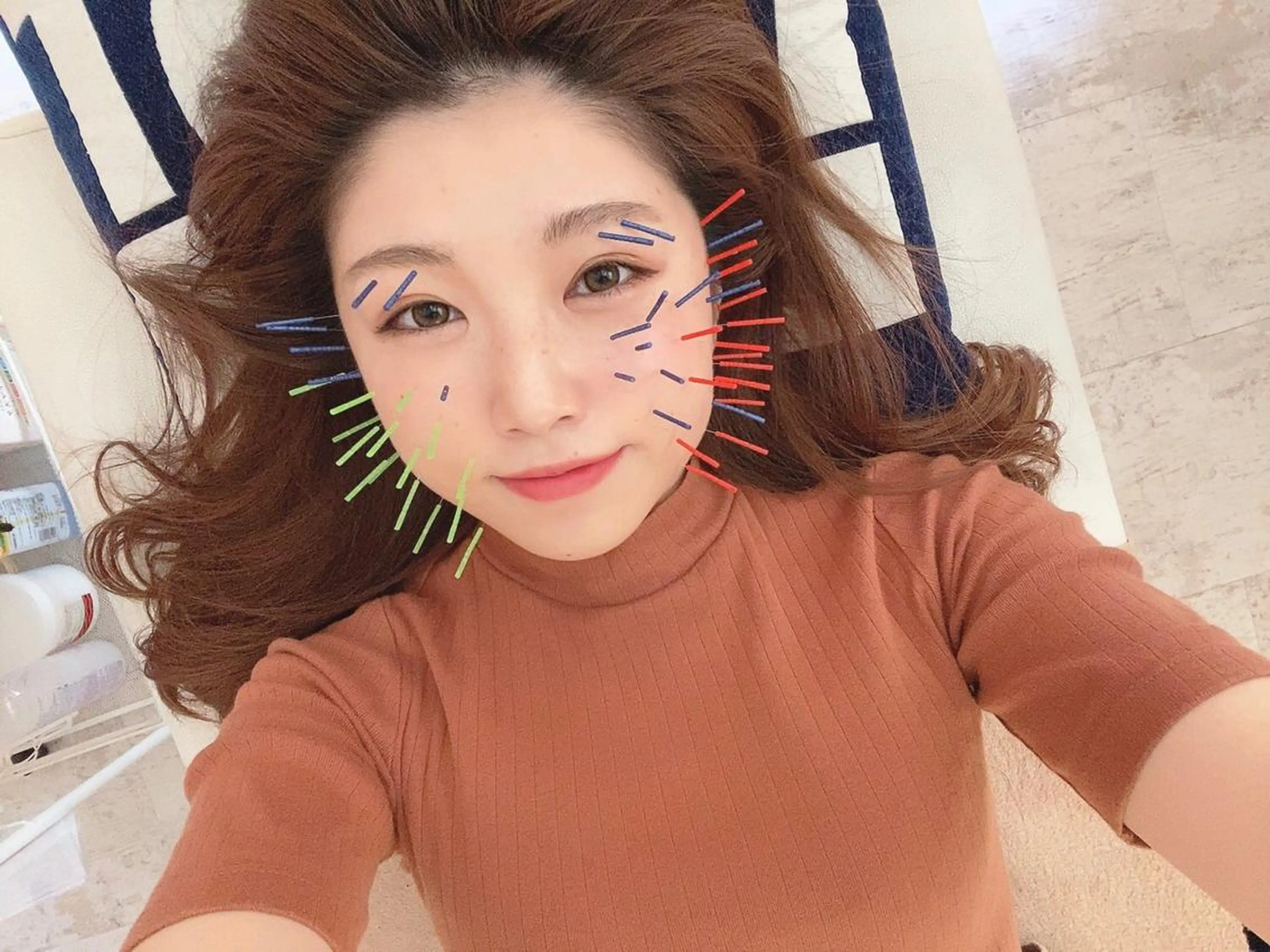 鍼灸整骨院Refine所属・鍼灸 Refineのその他イメージ