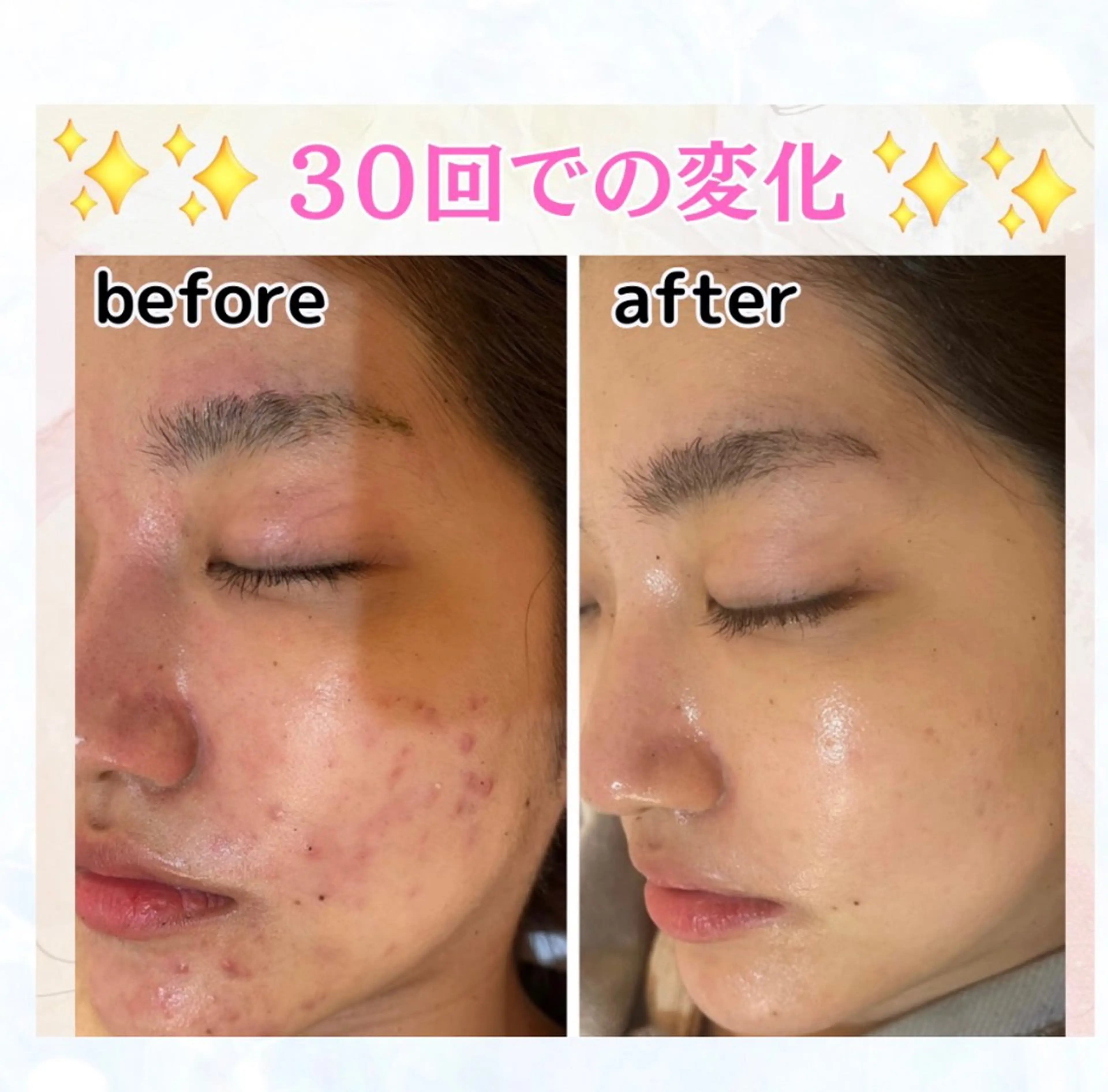 エステ ポテンツァ&針美容 バストアップ専門店のエステ・リラクイメージ