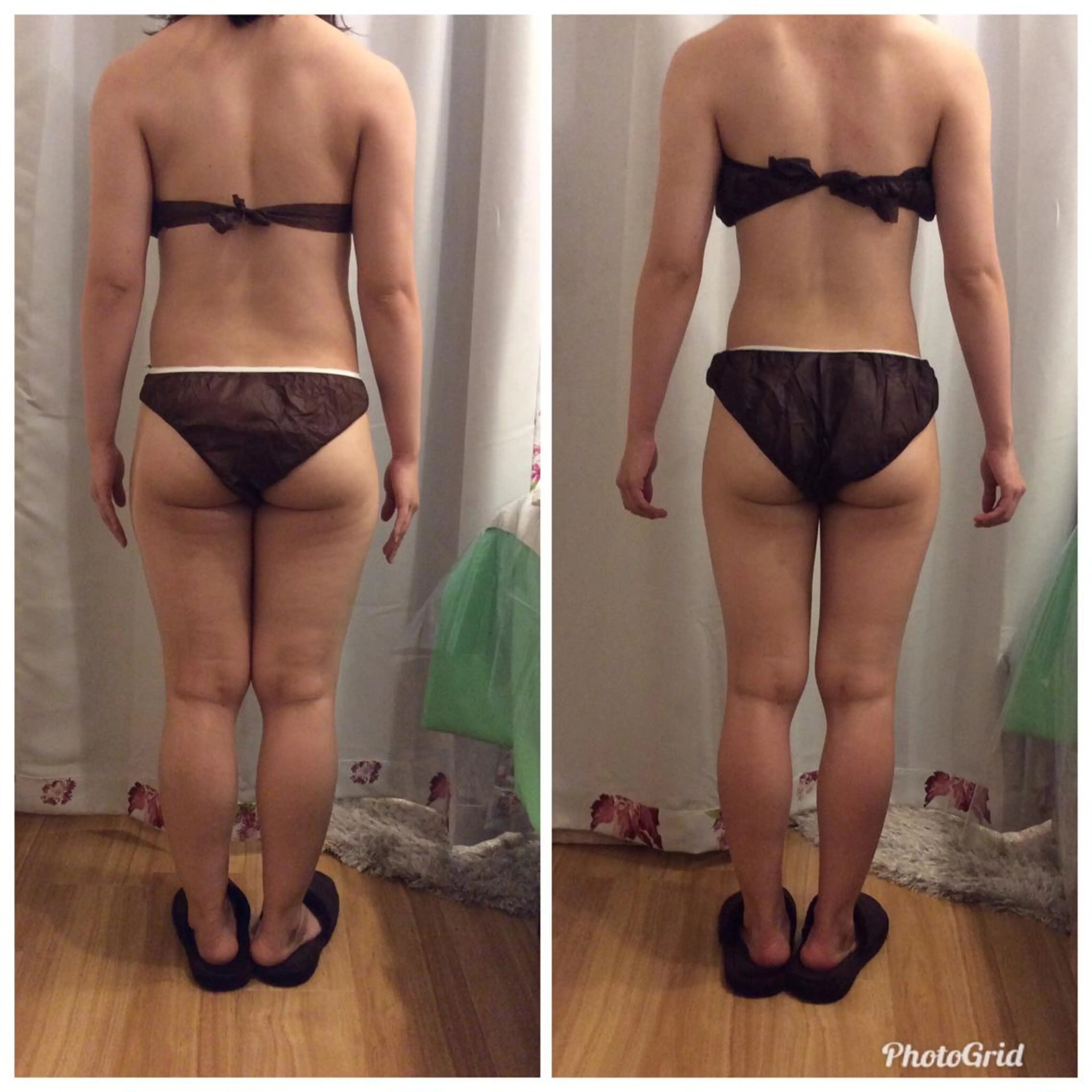 【minimo限定】特別ダイエットモニターコース60分×5回/約2ヶ月で➖3Kgを目指す！！の写真