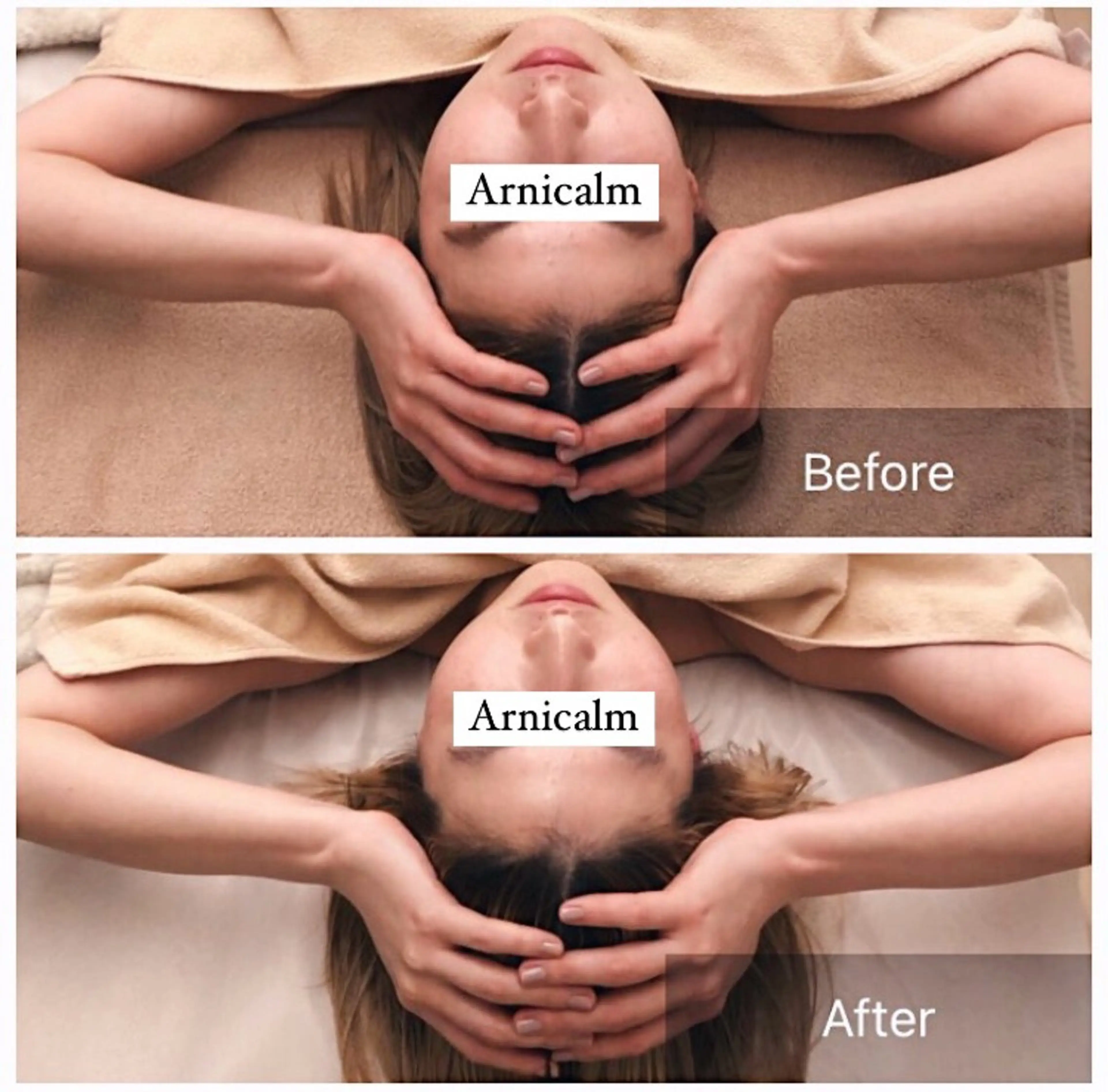 エステ ハーブピーリング 肌再生ピーリング/のエステ・リラクイメージ