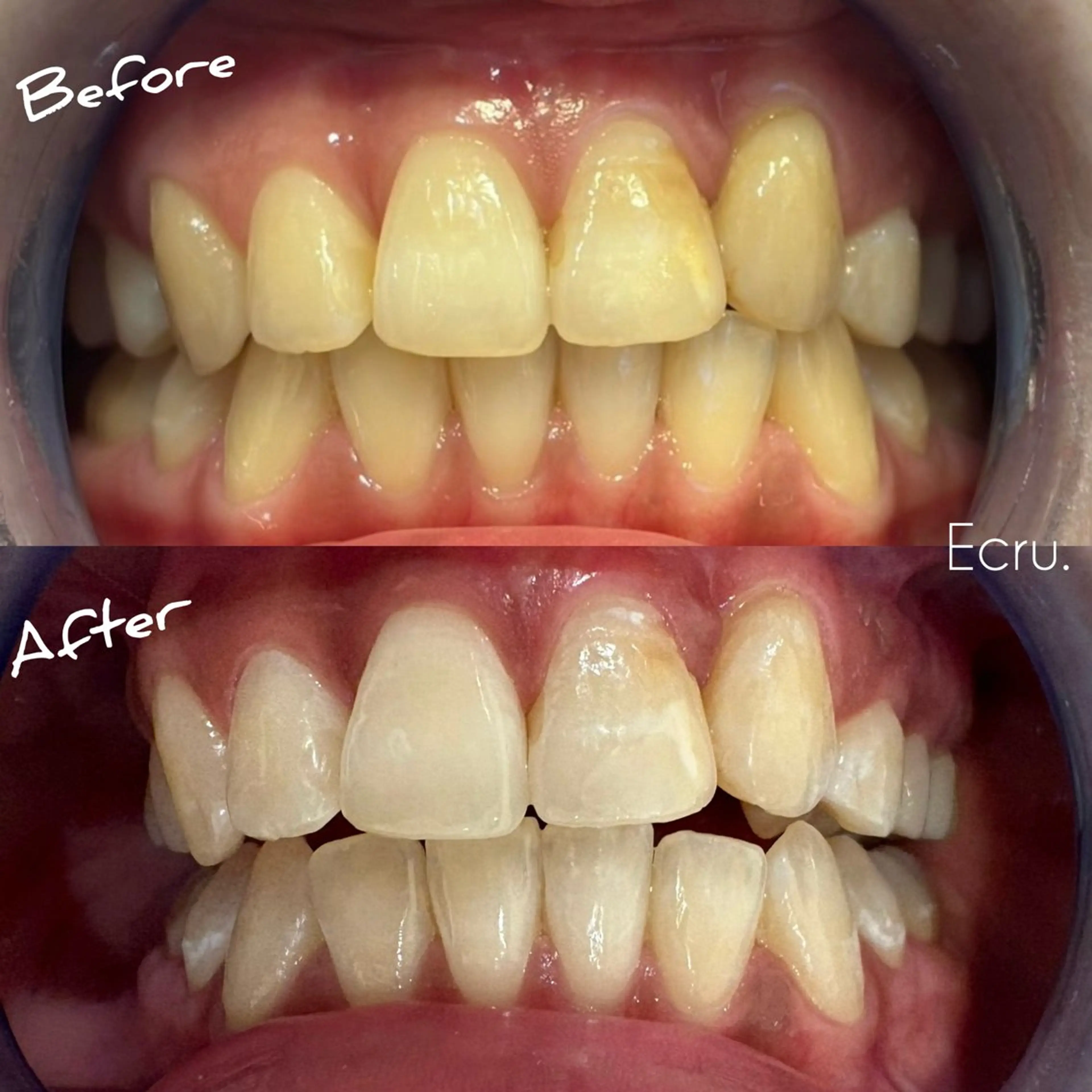 メンズ キッズ エステ ホワイトニングサロン Ecru所属・ホワイトニングサロン Ecru エクリュのその他イメージ