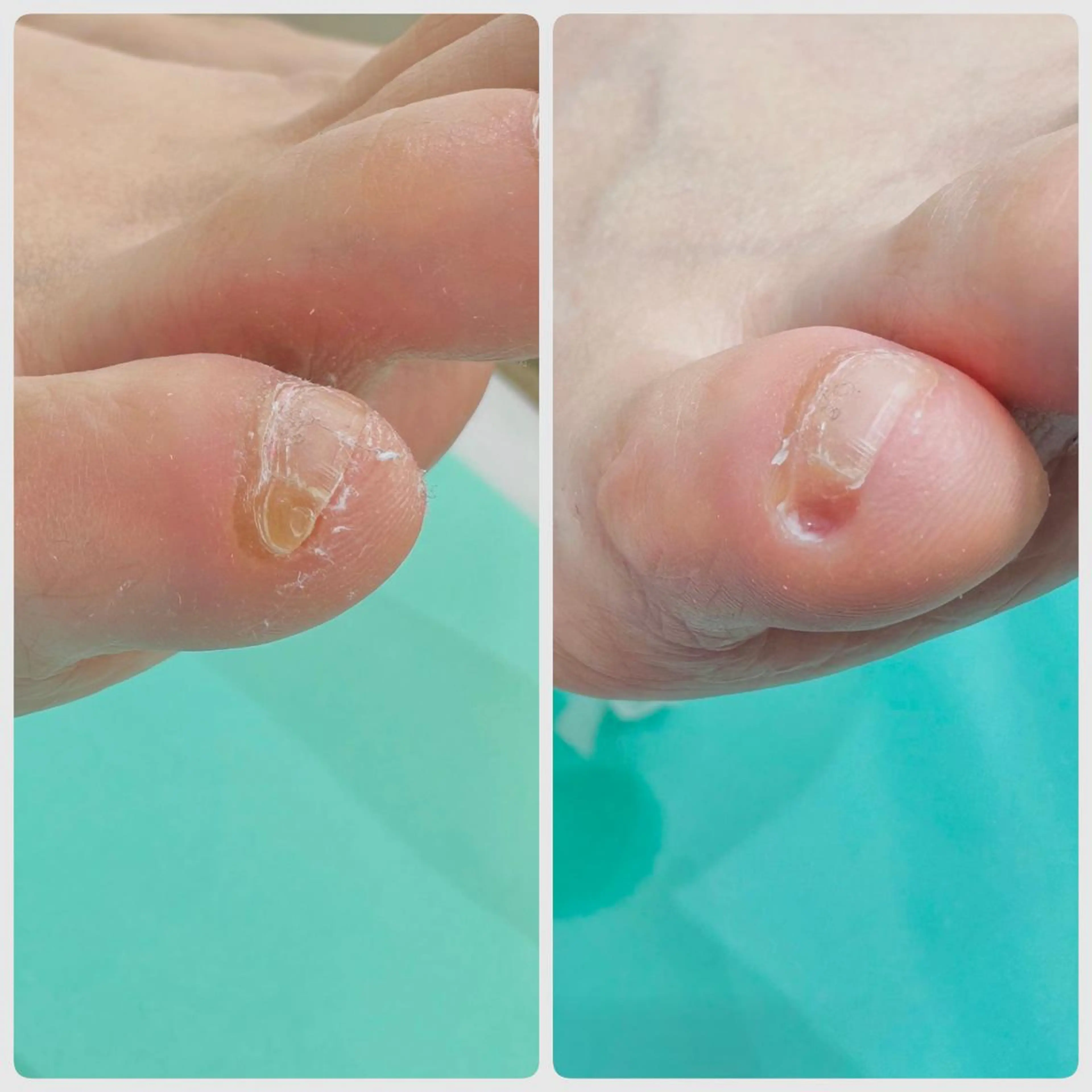 東京巻き爪アカデミー所属・東京巻き爪 アカデミーのエステ・リラクイメージ