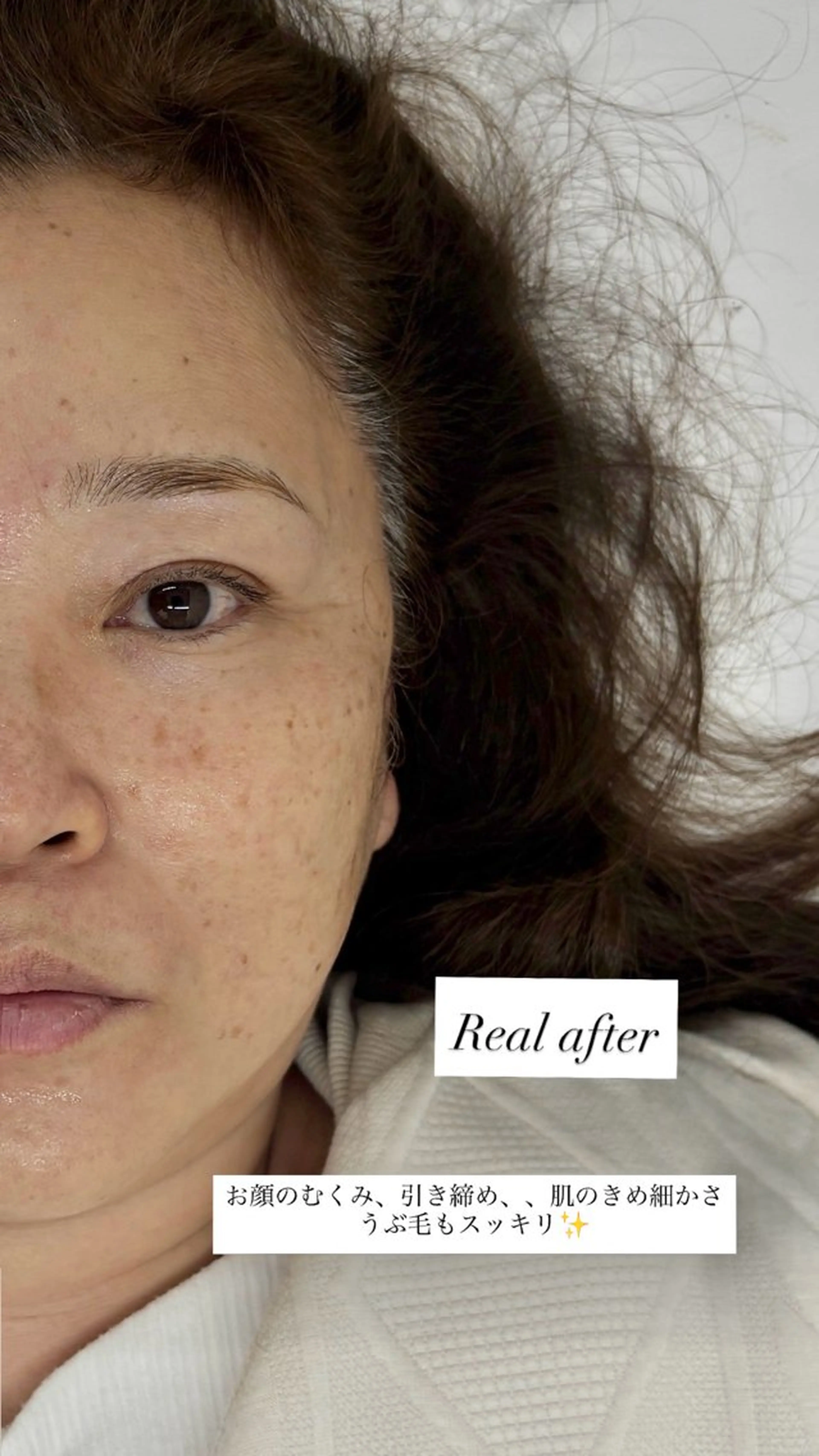 エステ 垢抜け美眉肌♡ /momoka.kaのエステ・リラクイメージ