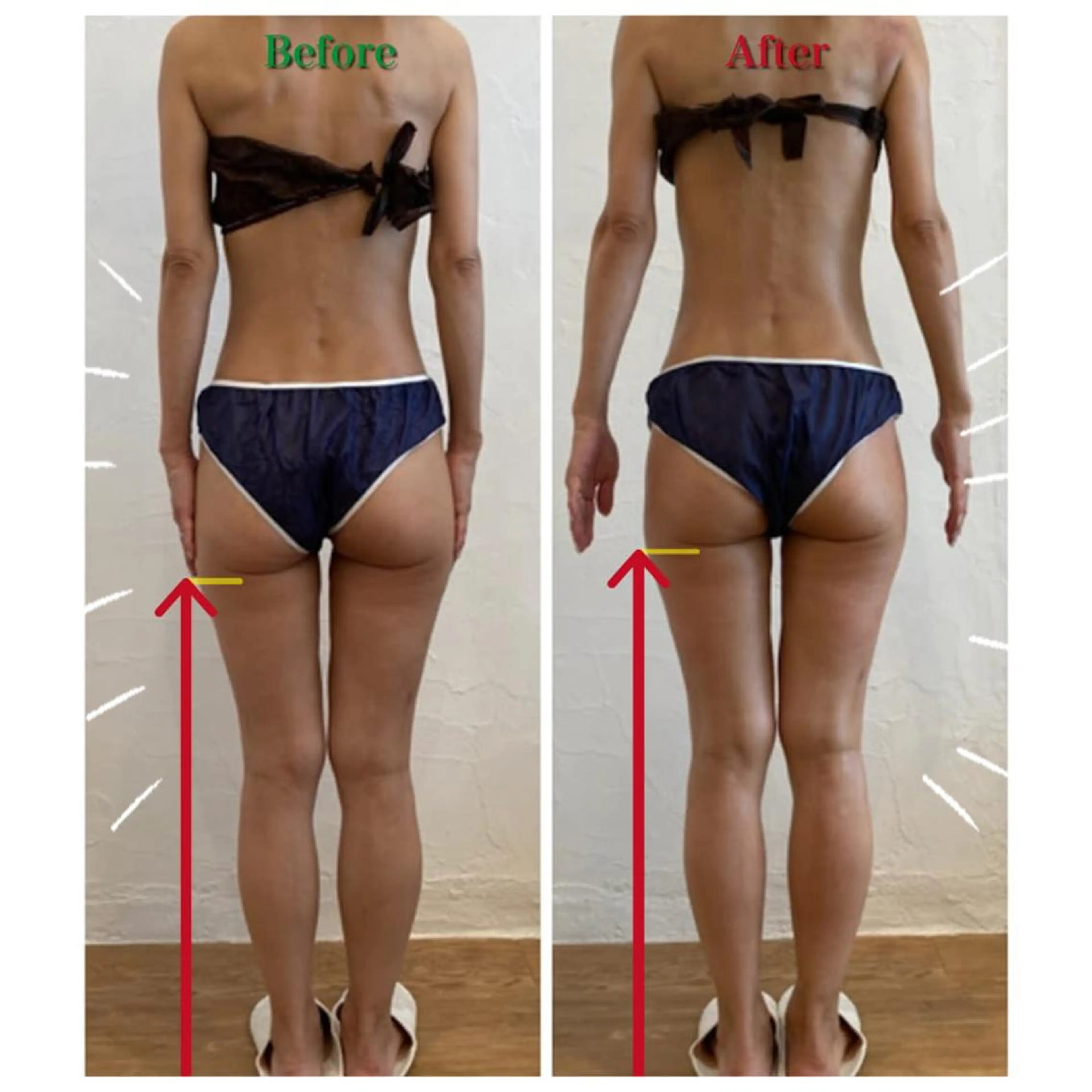 エステ リラク むくみ専門痩身 マクイエステティックのエステ・リラクイメージ