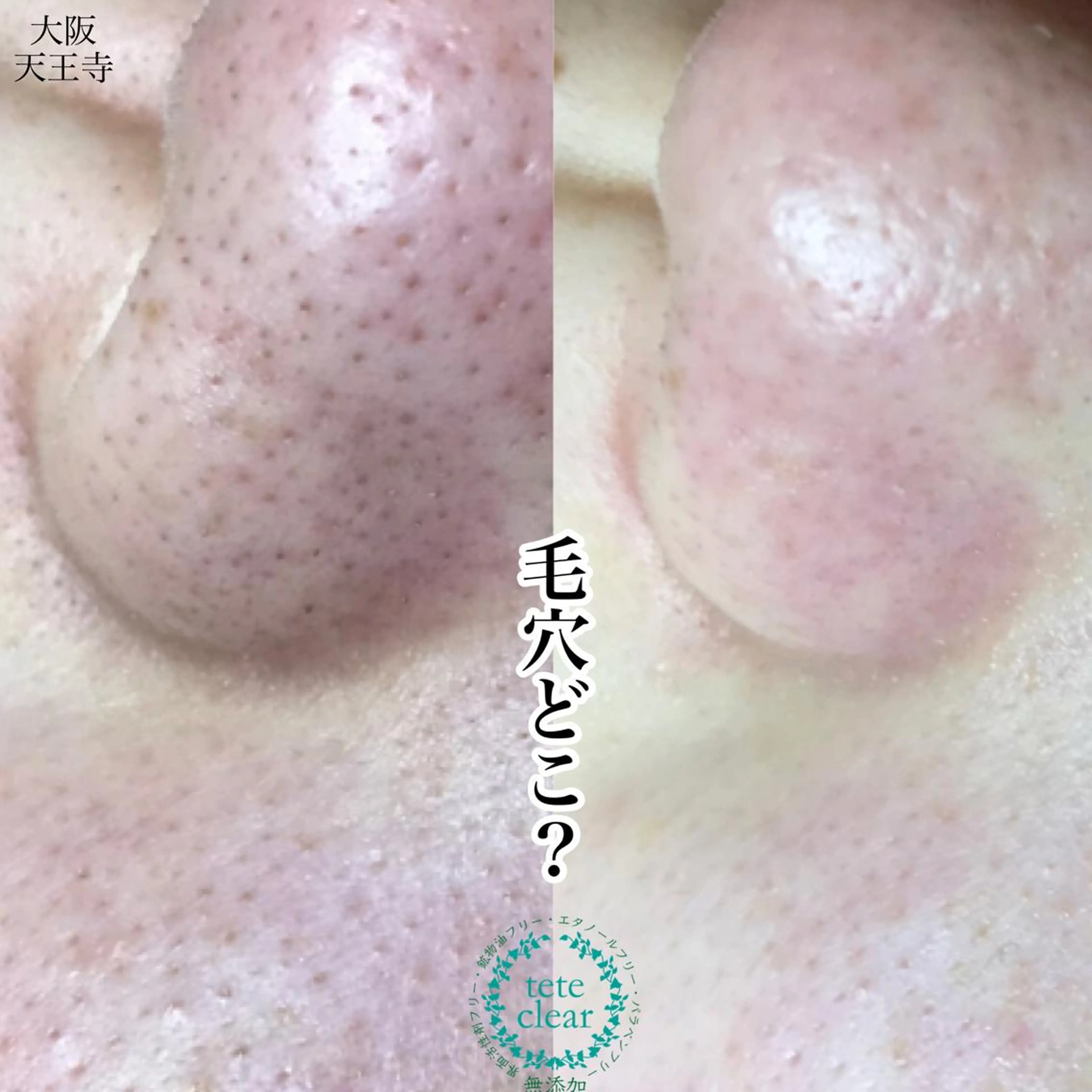 マツエク・マツパ 【しみ毛穴専門店】beautysalon Ankh所属・しみ毛穴専門店 Ankh 平田のエステ・リラクイメージ