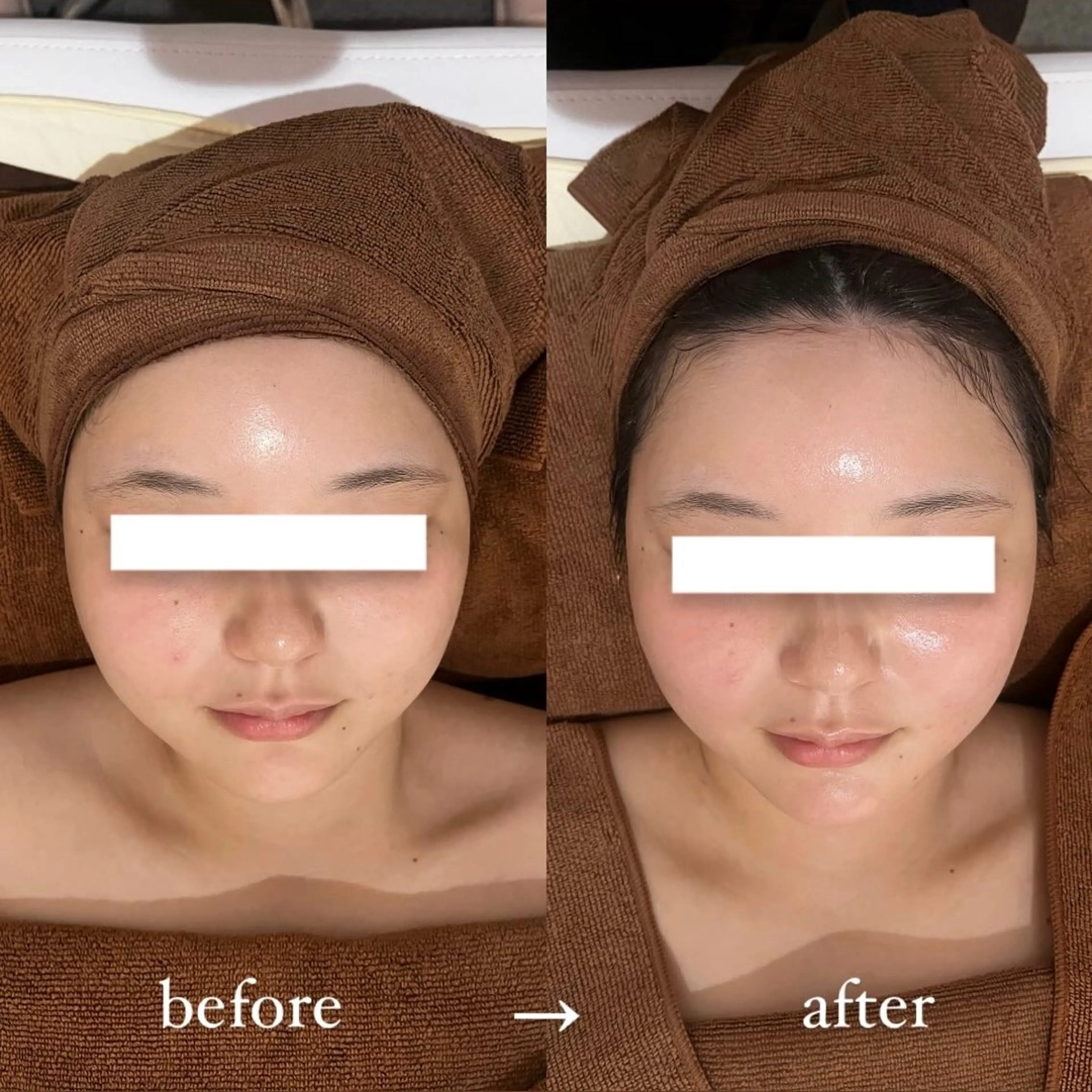 NOEL所属・フェイシャルエステ Utaiのエステ・リラクイメージ