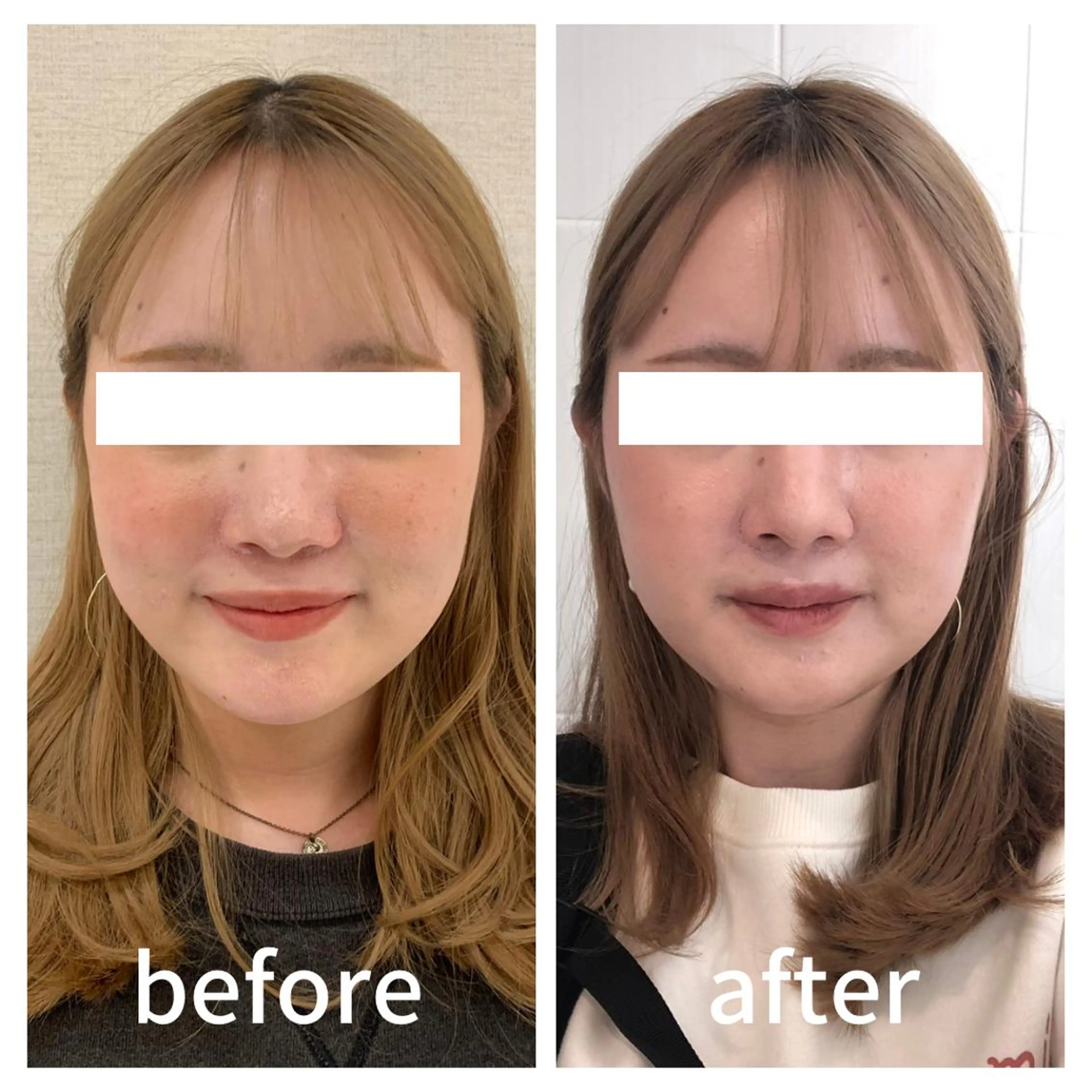 小顔サロン AMYONのエステ・リラクイメージ