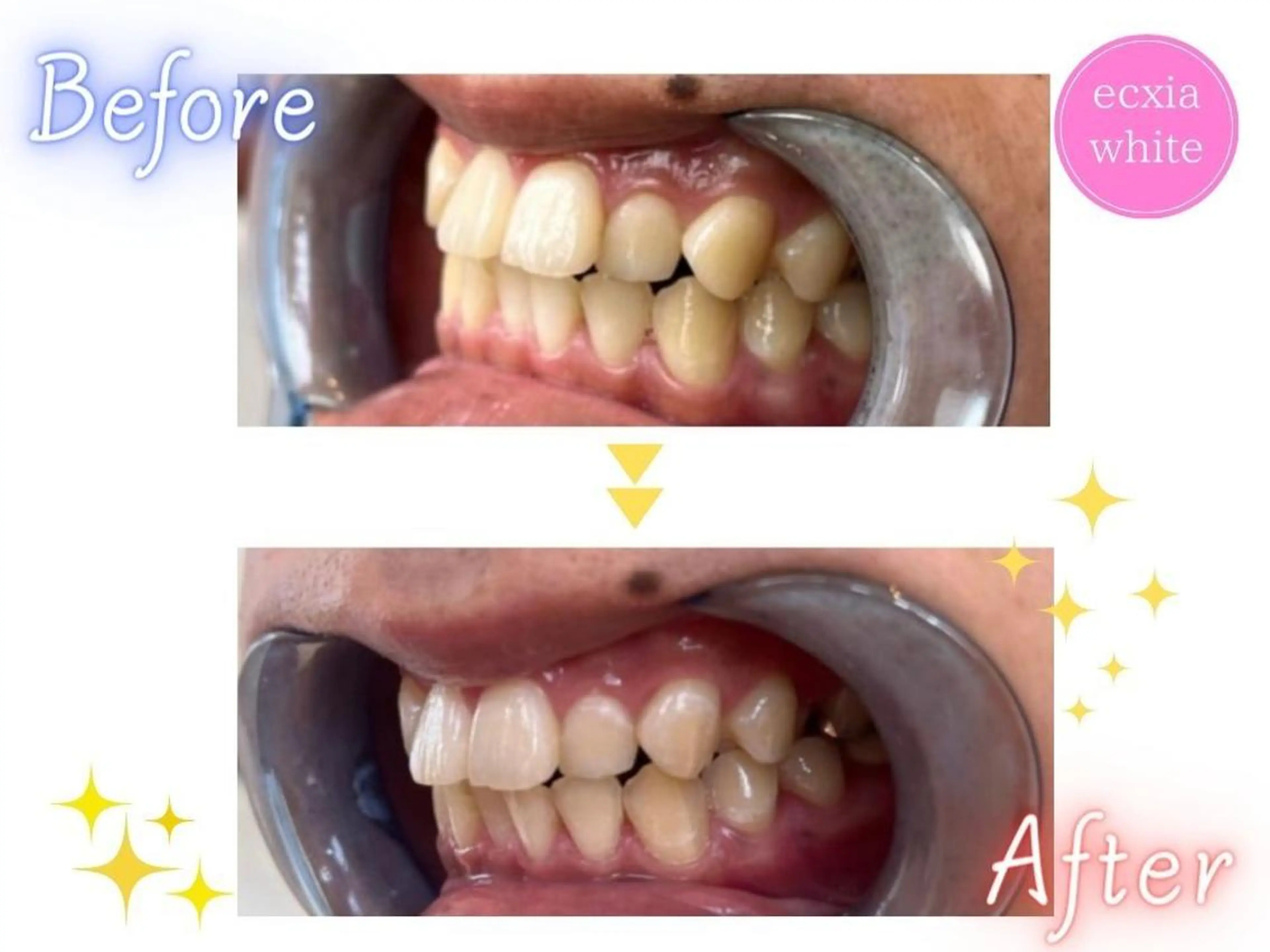 セルフホワイトニング エクシア東上野店のその他イメージ