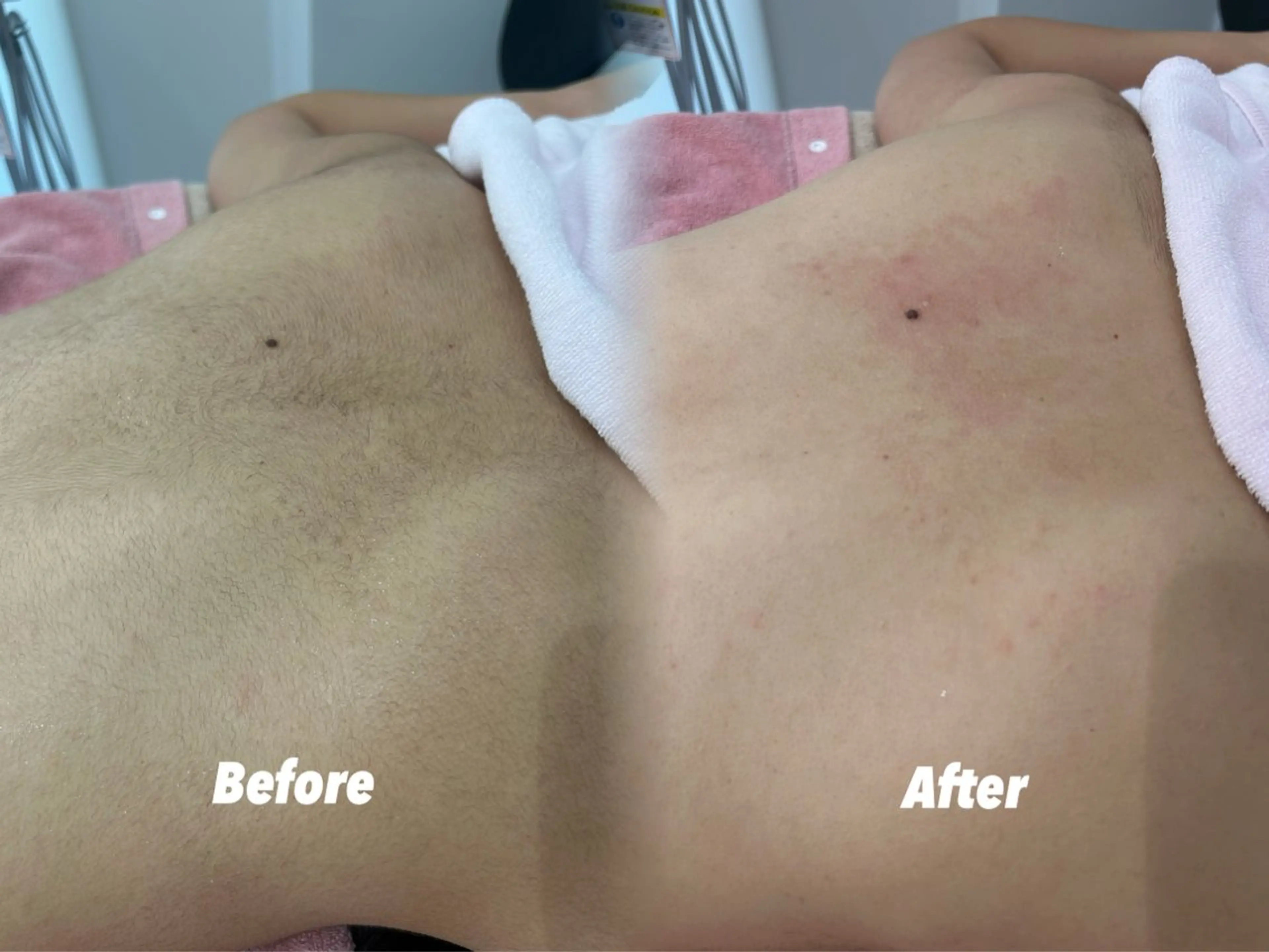 その他 🫧美しい素肌へ🫧 今成柚乃のその他イメージ