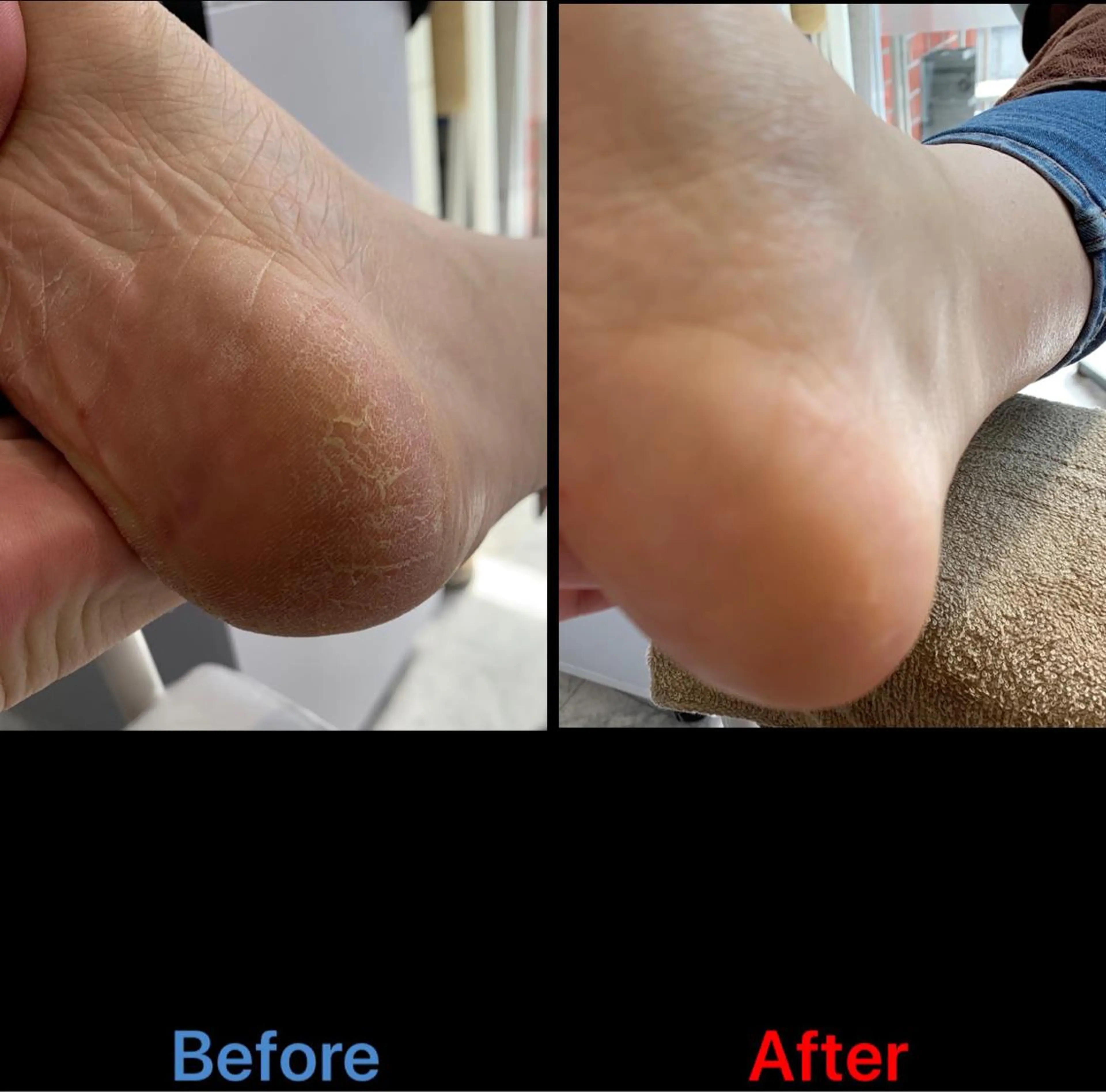 ネイル 毛穴改善/脱毛 ネイル　川上久仁子のエステ・リラクイメージ