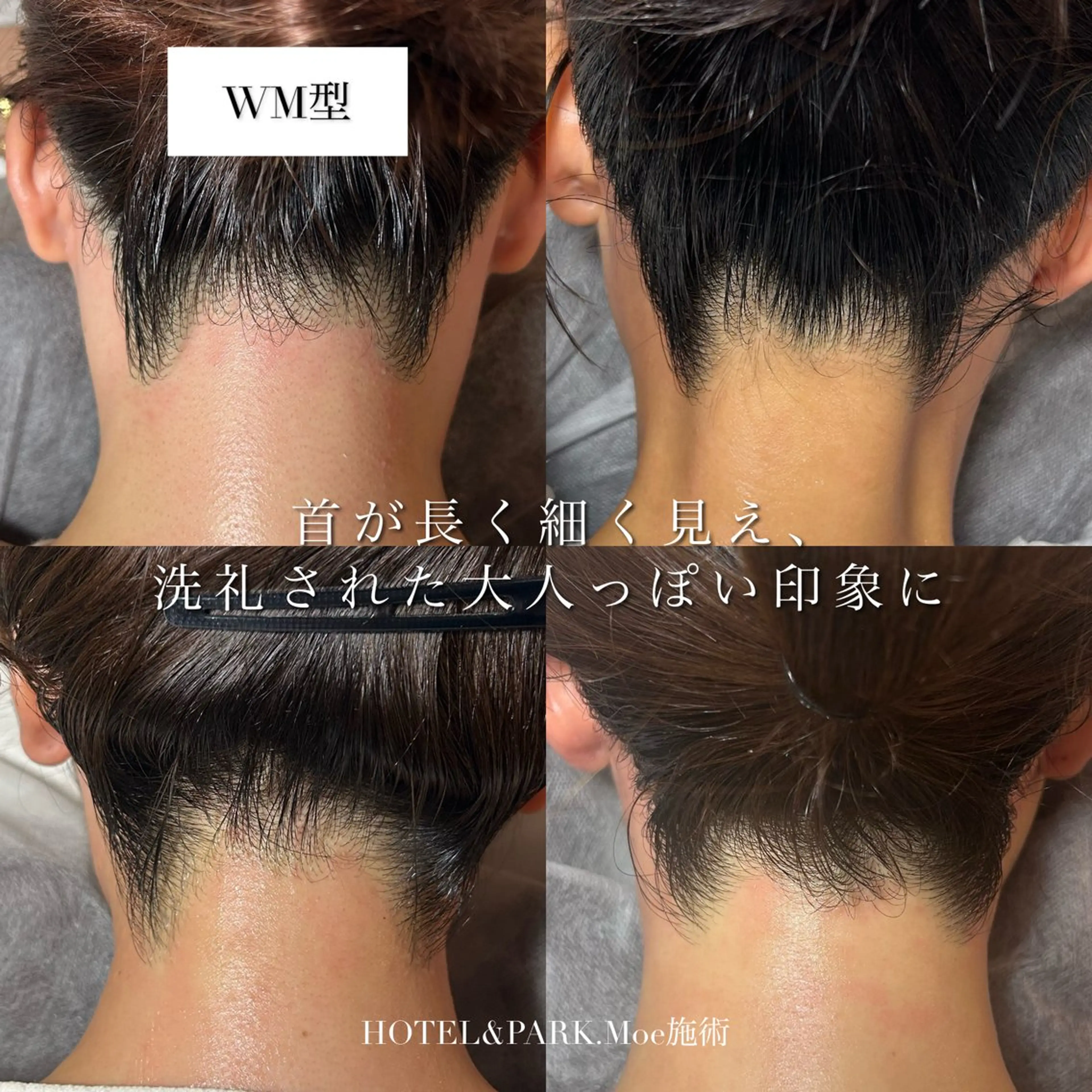 脱毛 HOTEL&PARK .Moeワックス脱毛のエステ・リラクイメージ