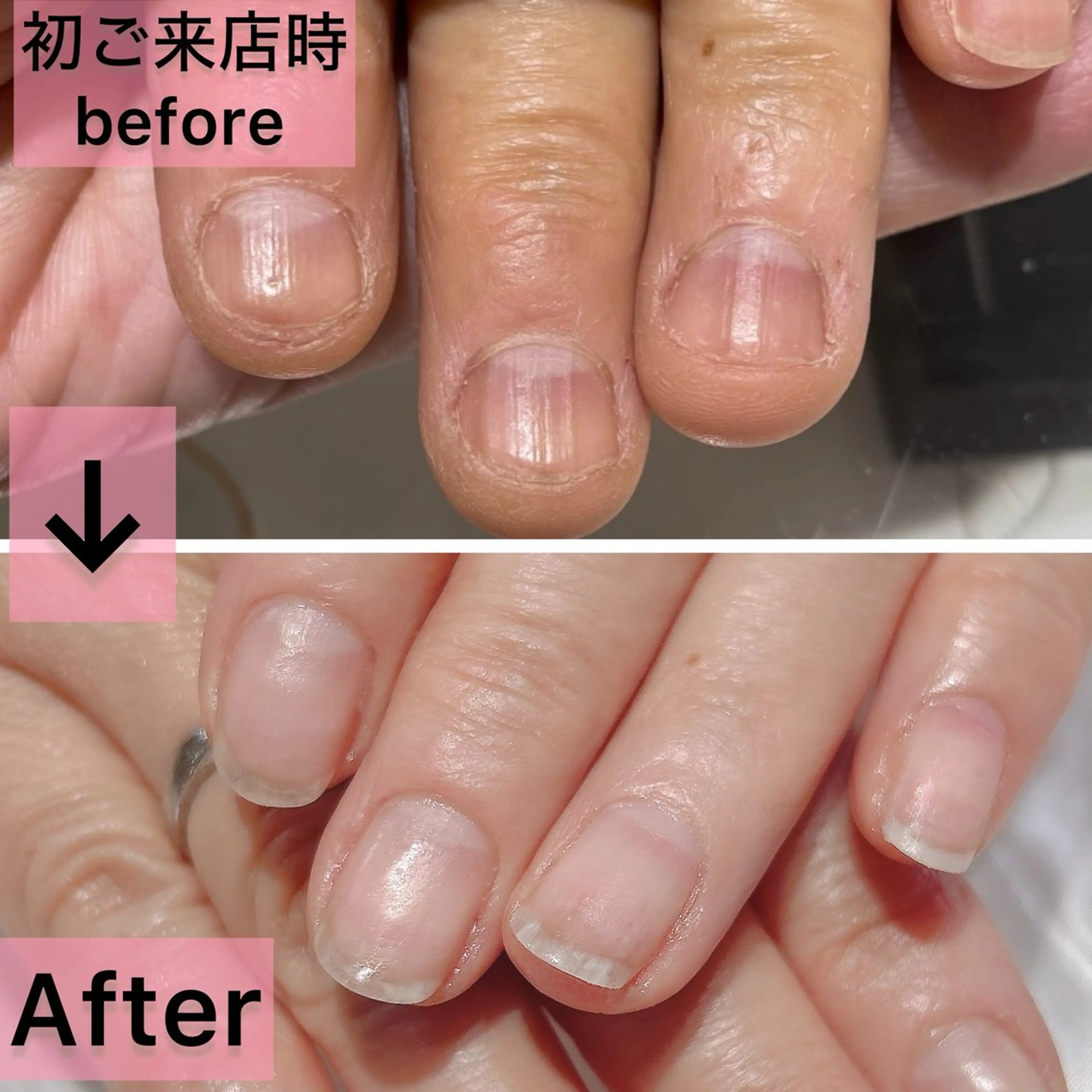 ネイル フットネイル ジェルネイル マグネットネイル パラジェル ハンドネイル Nail×Lani 深爪矯正対応◎のネイルデザイン