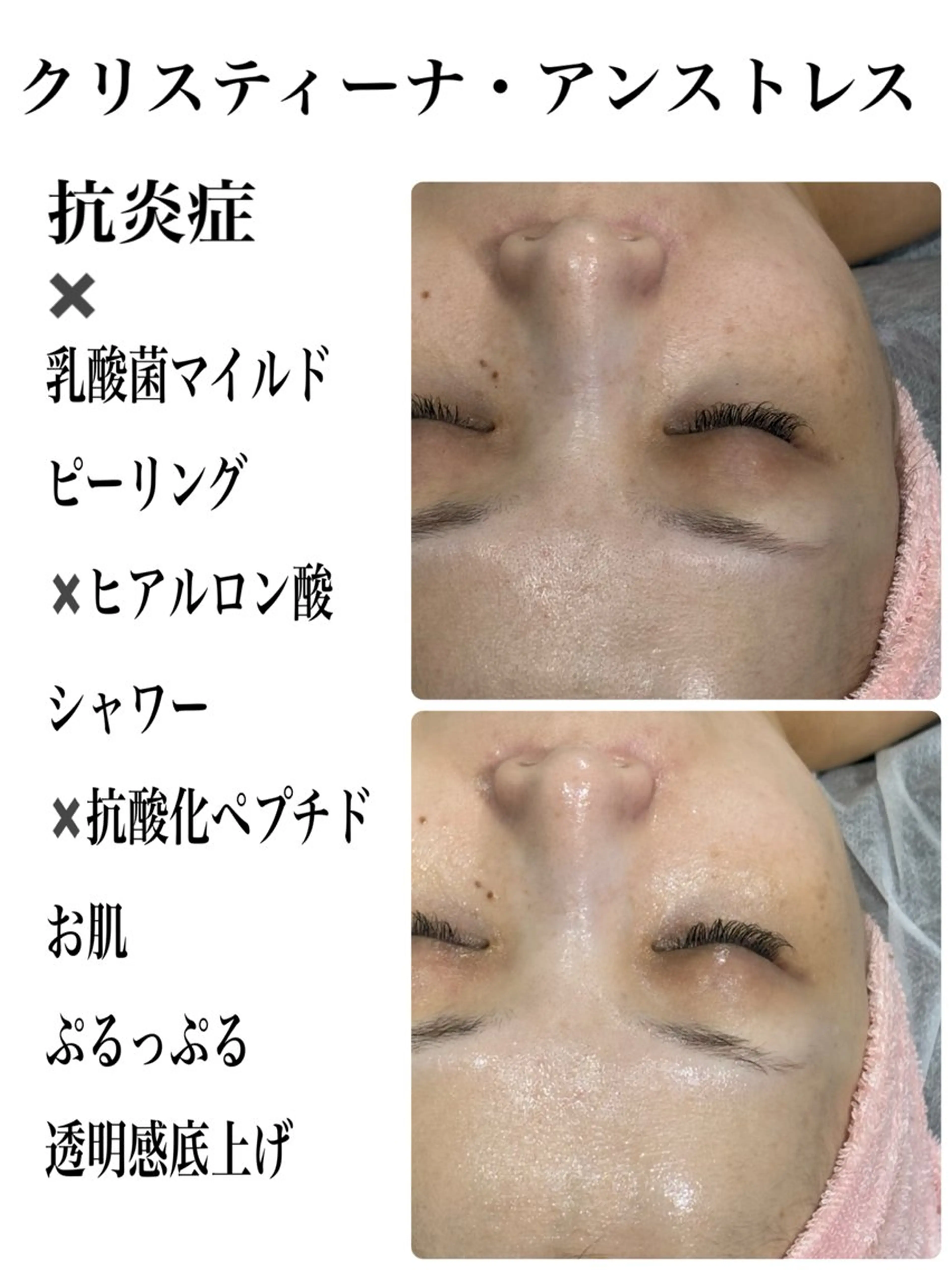 肌質を自分史上最強の理想状態に🩵クリスティーナ2種/72時間スキンインプラントEXOMERE/IPL光フェイシャル🩵の写真