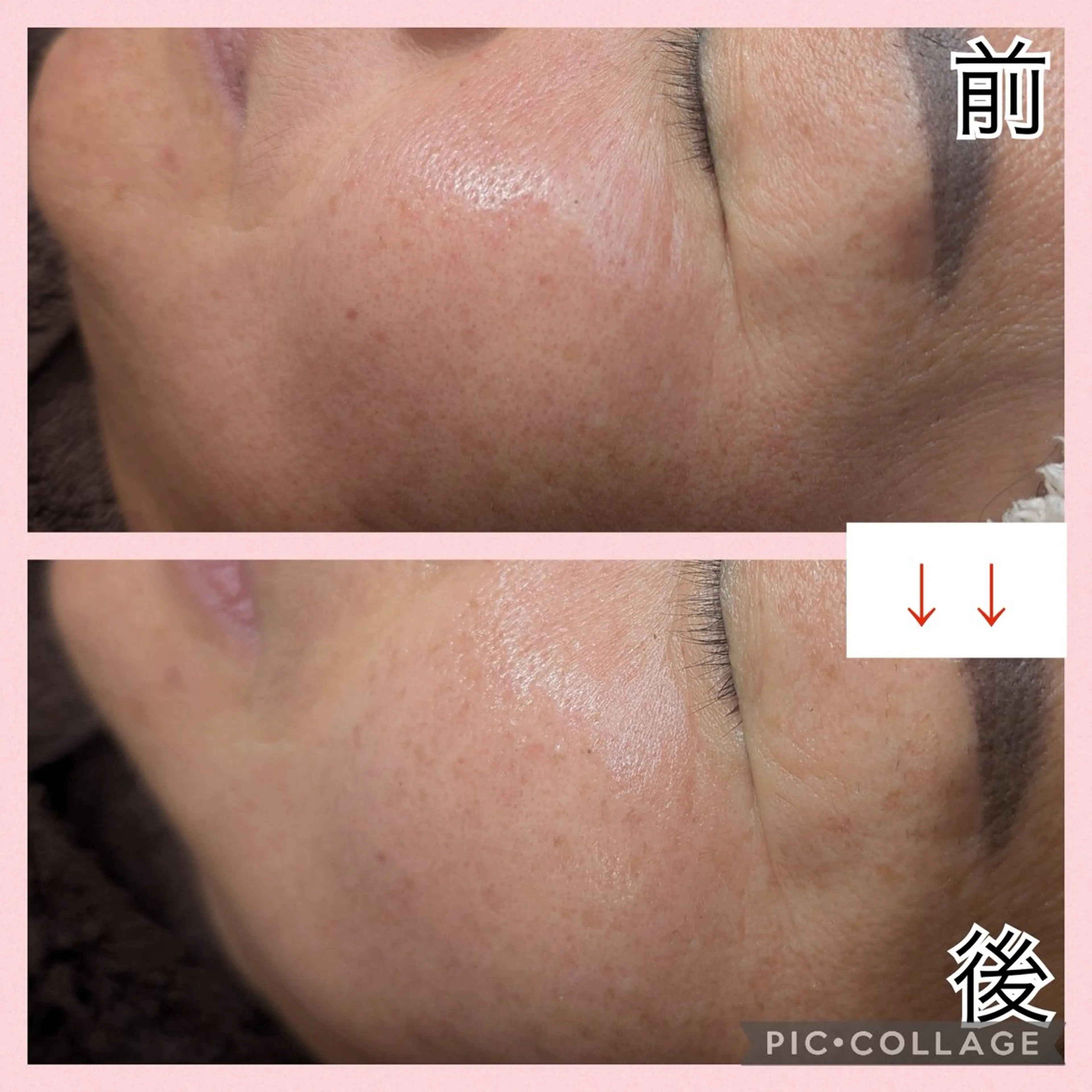 肌質改善プライベートサロンwith U所属・肌質改善サロン with Uのエステ・リラクイメージ