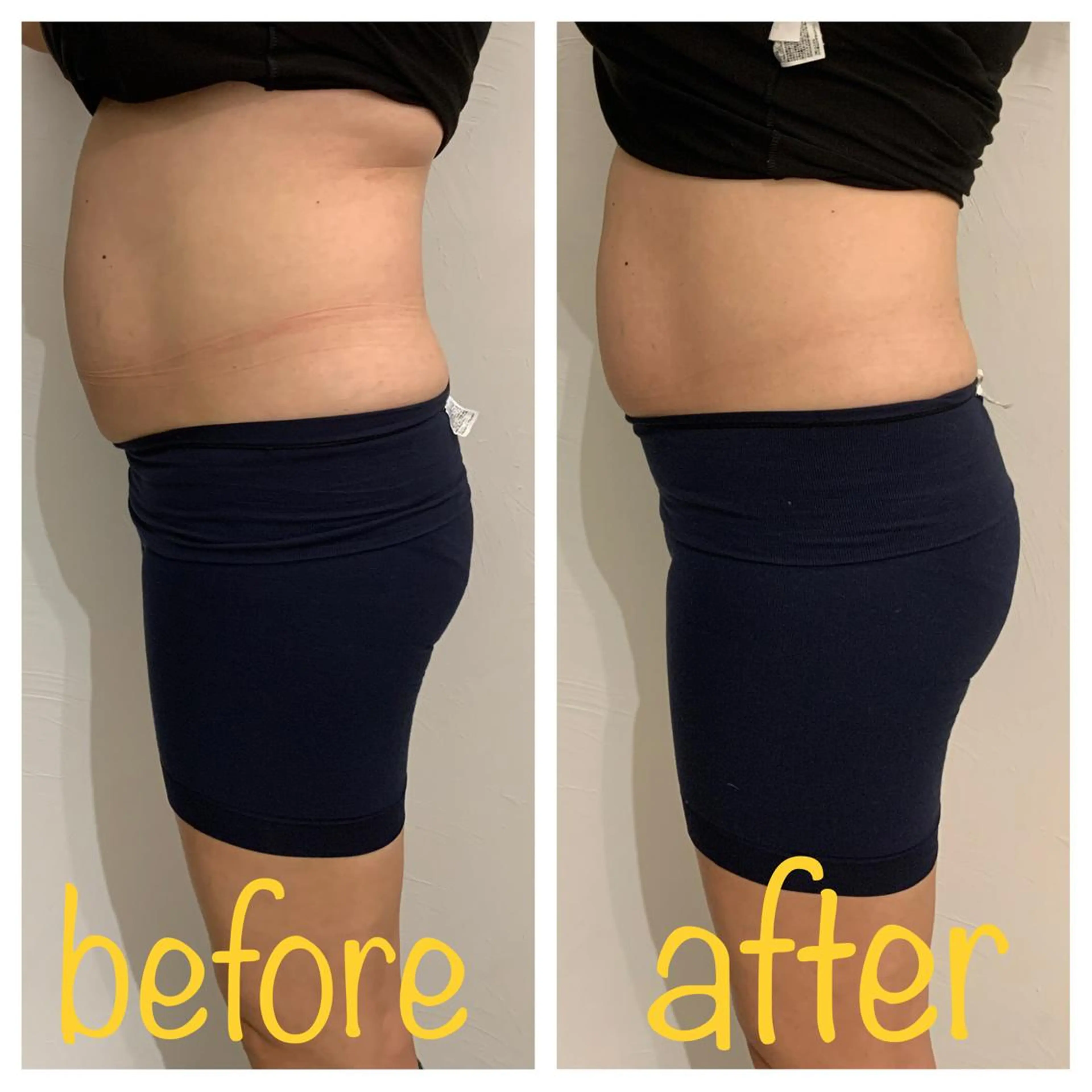 リンパマッサージ&ピラティスmimoza所属・リンパマッサージ mimozaのエステ・リラクイメージ