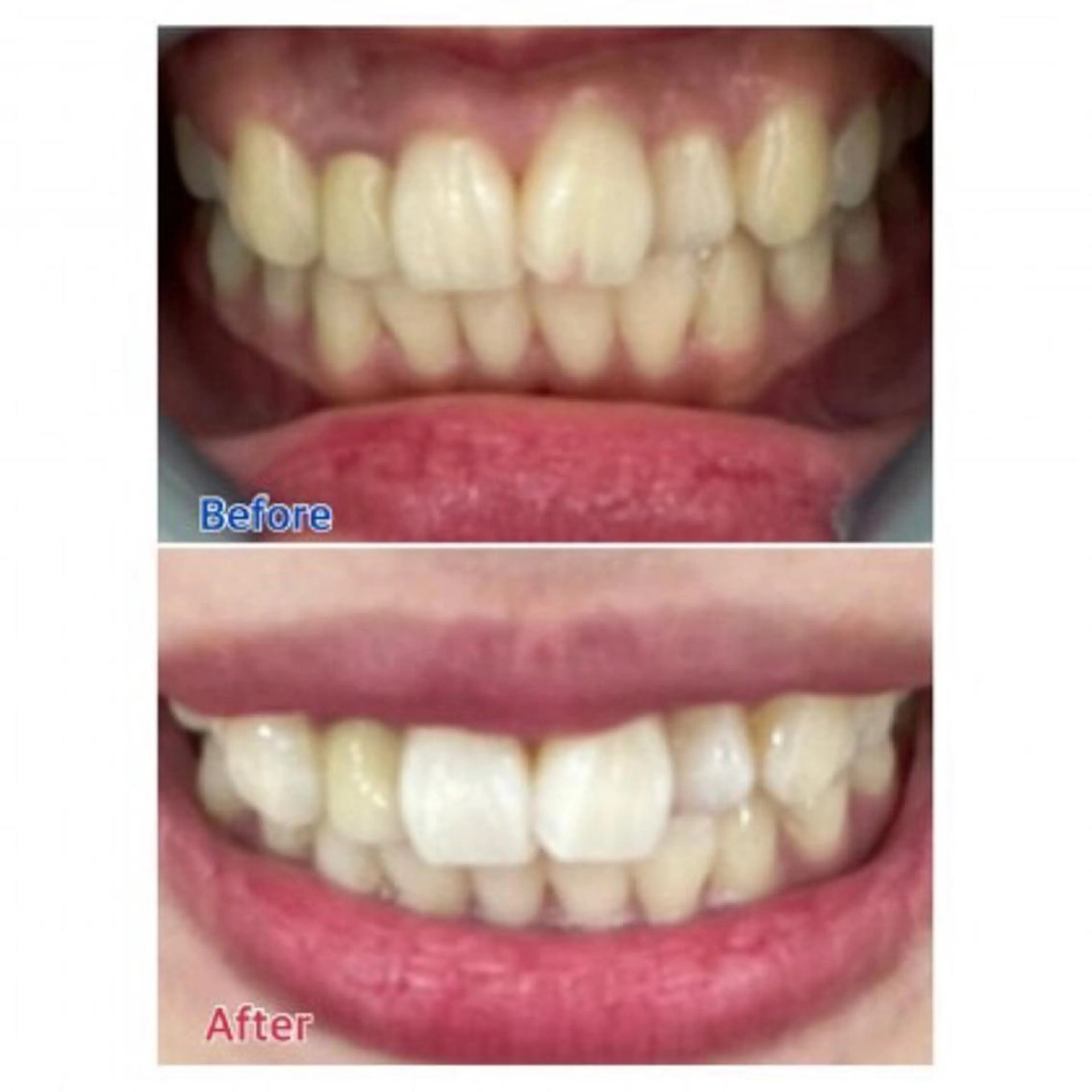 M渋谷店所属・Ｍ渋谷 ホワイトニングのエステ・リラクイメージ