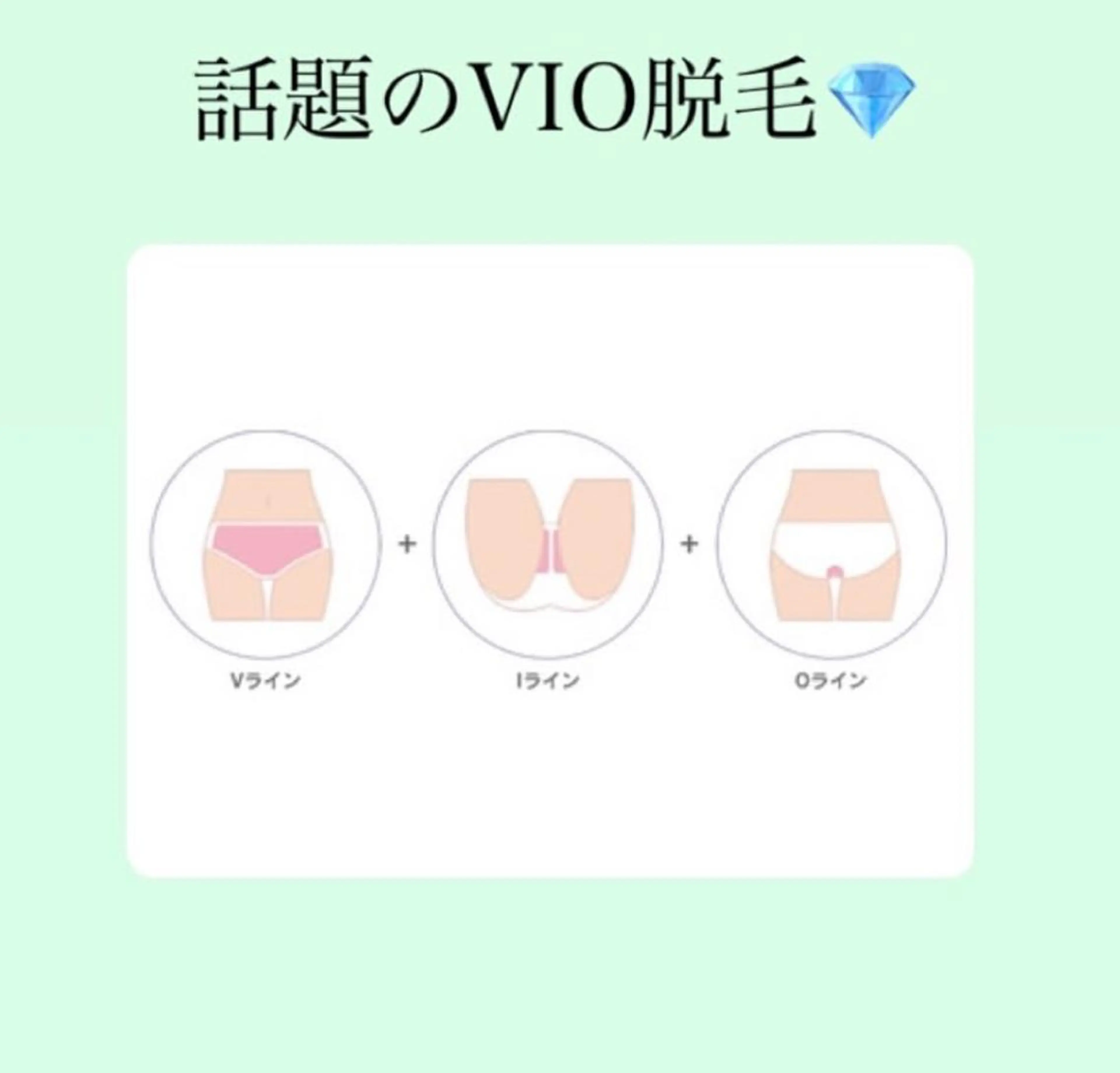 ツルツルVIO脱毛体験の写真