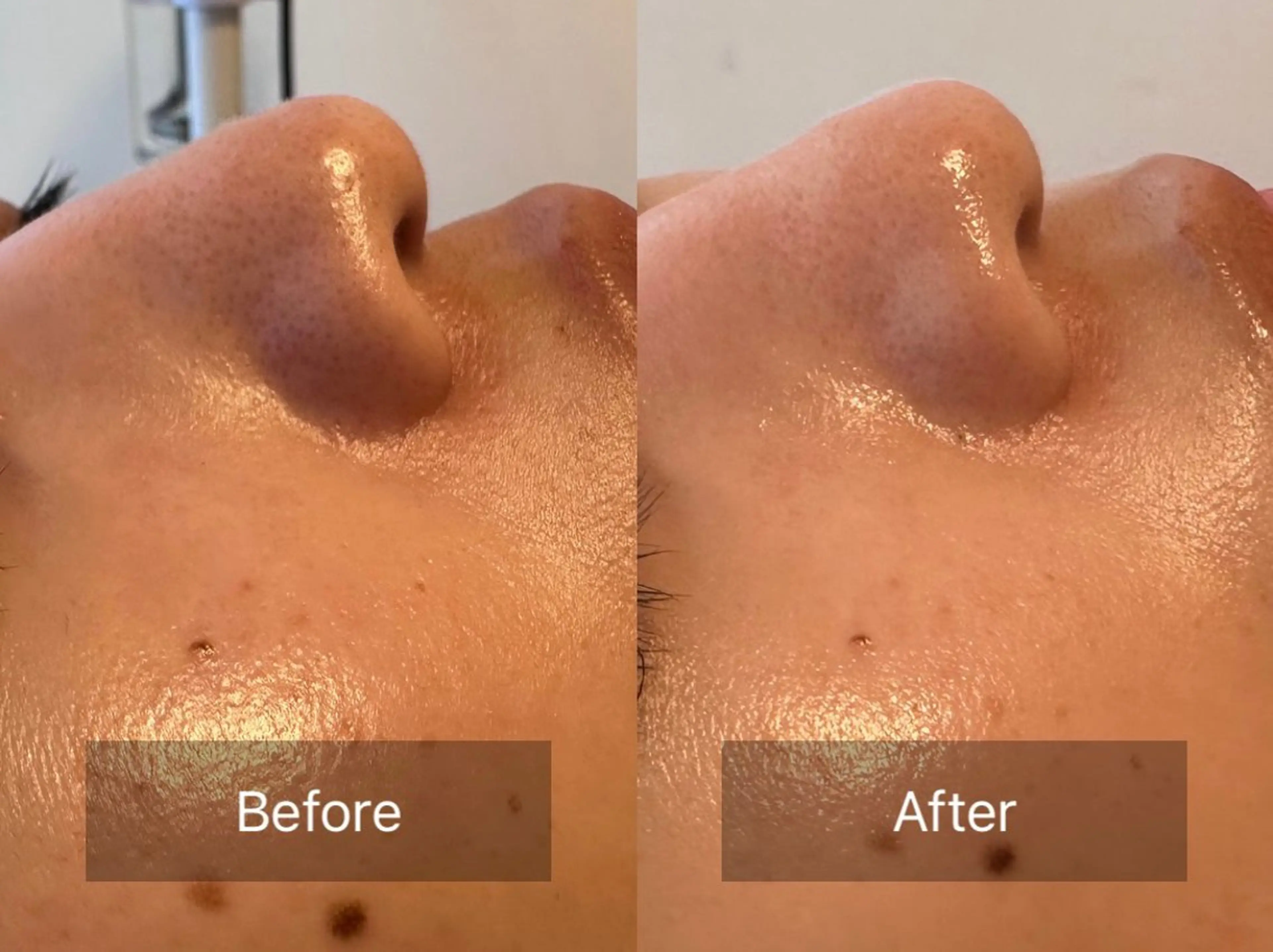 エステ 天使の艶肌　REVIハーブピーリング＆ヘッドスパ 武蔵小杉店所属・天使の 艶肌のエステ・リラクイメージ