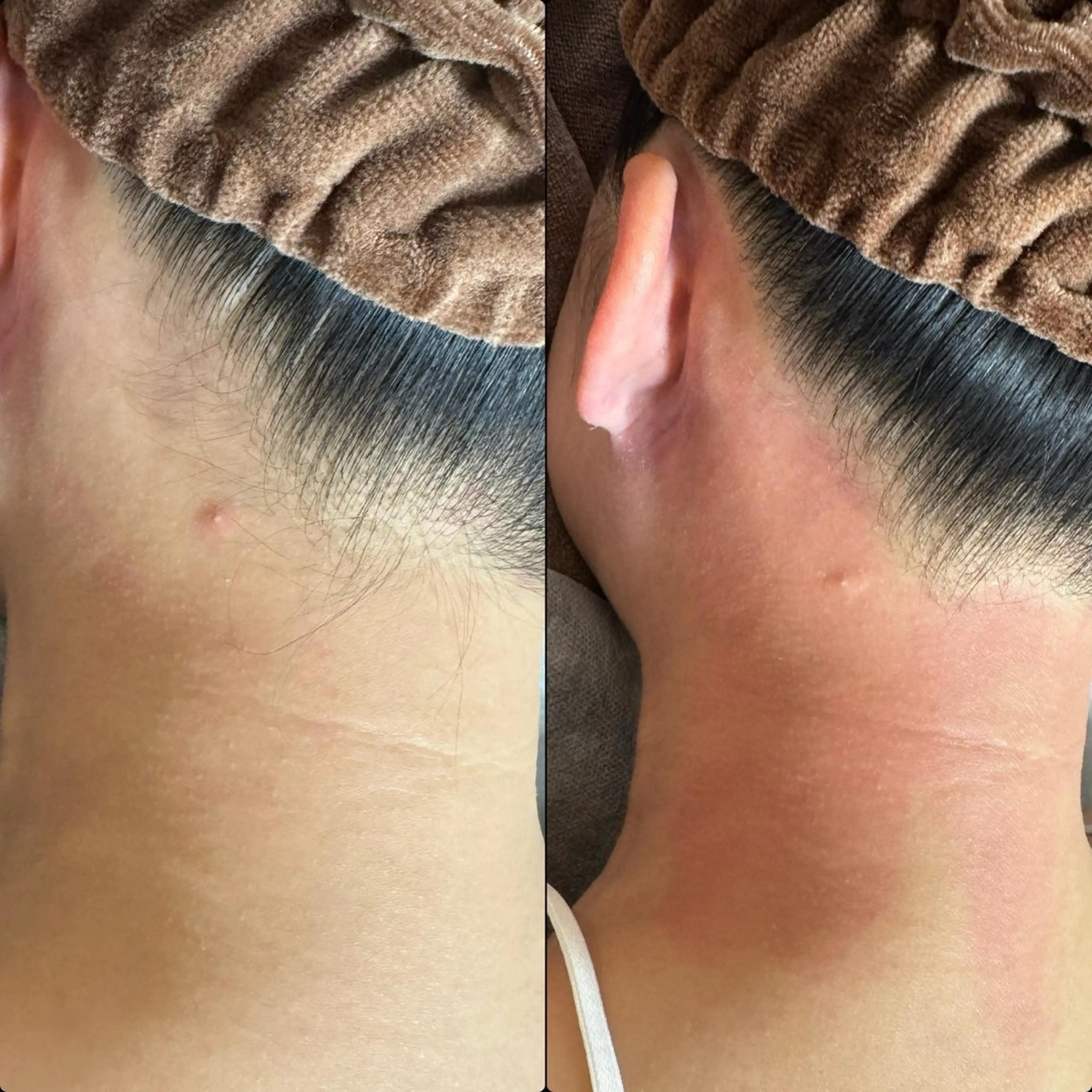 六本木脱毛andS さおりのエステ・リラクイメージ