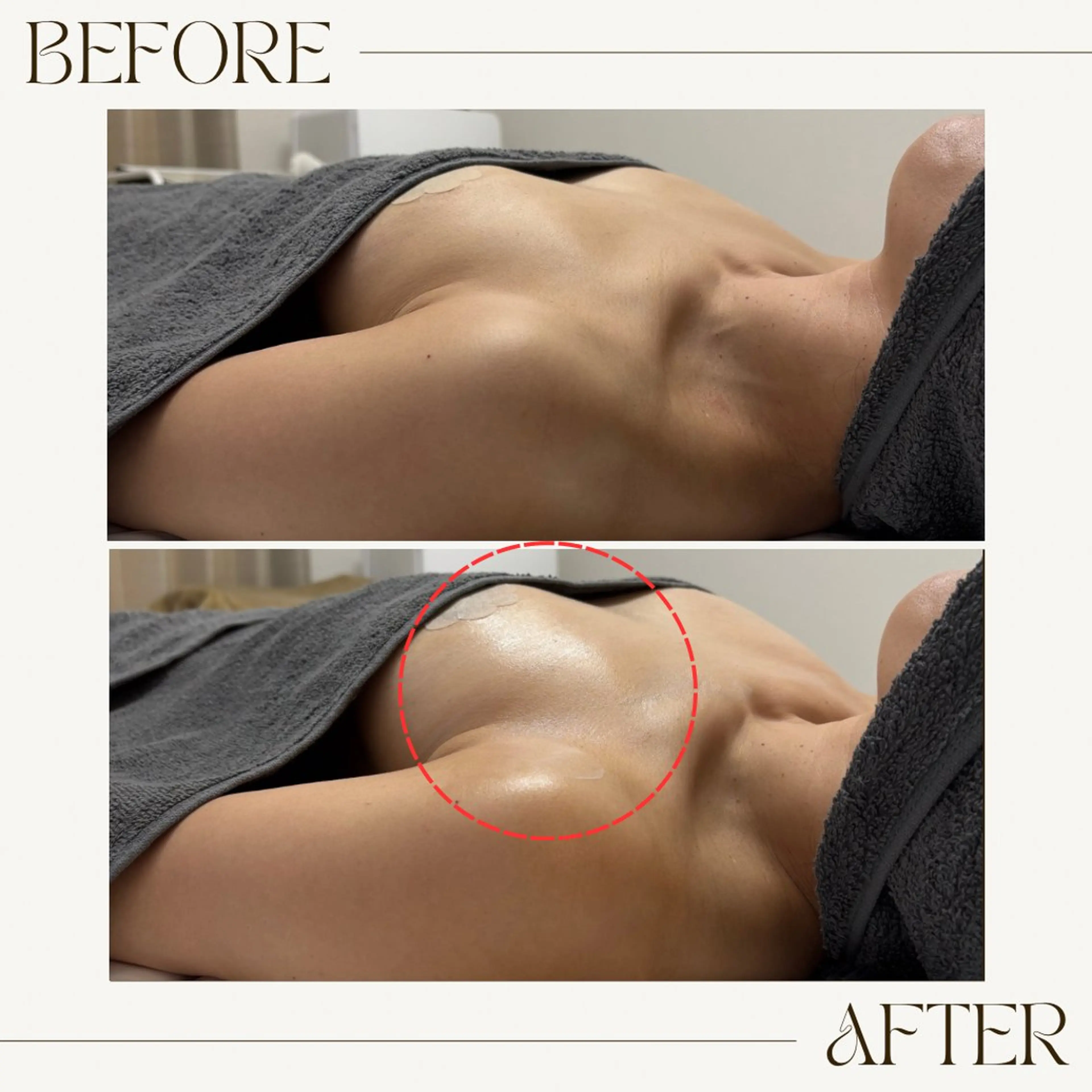 バストケア専門店| canyのエステ・リラクイメージ