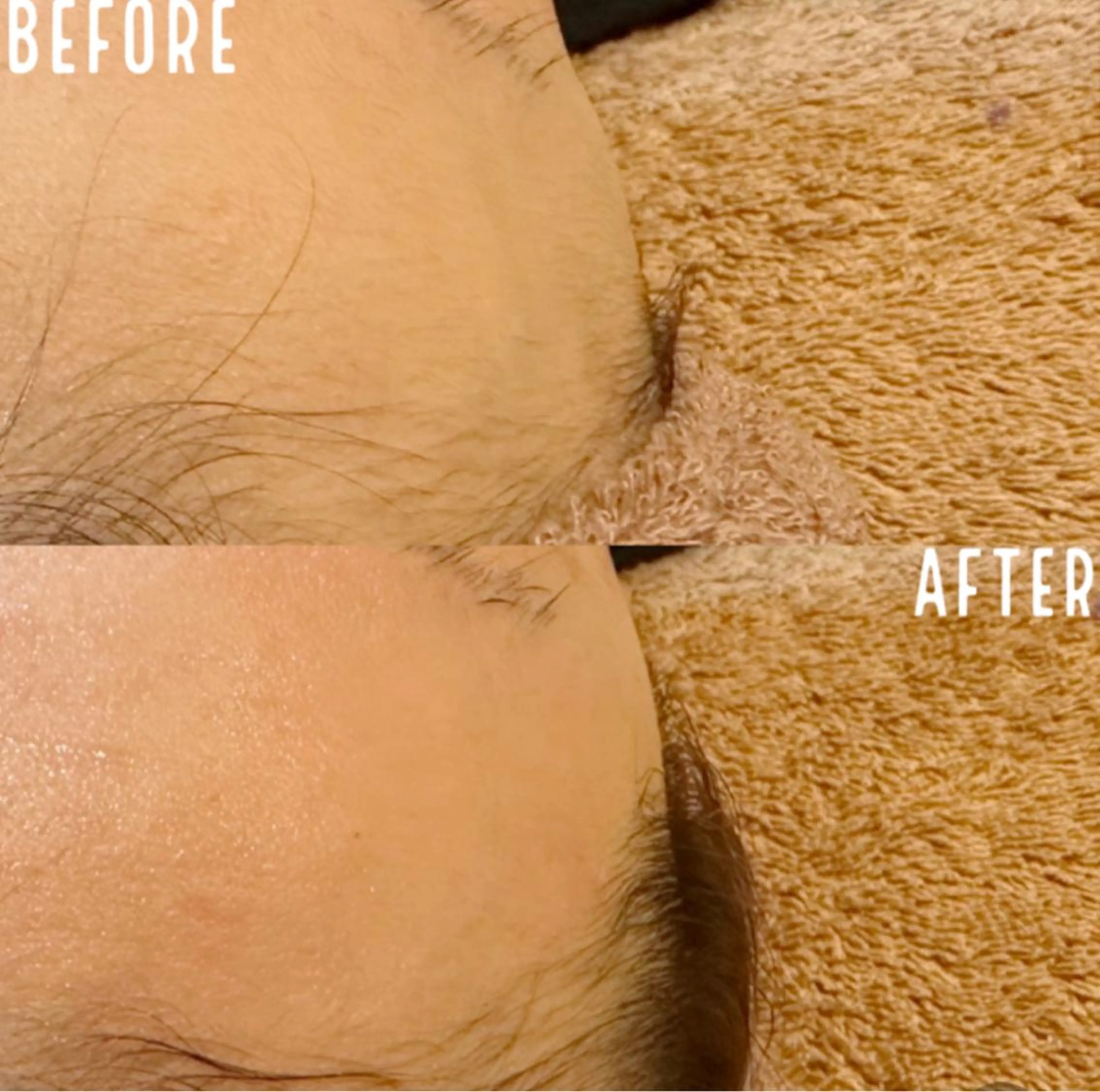 脱毛 KOHOLA -ワックス脱毛専門-のエステ・リラクイメージ