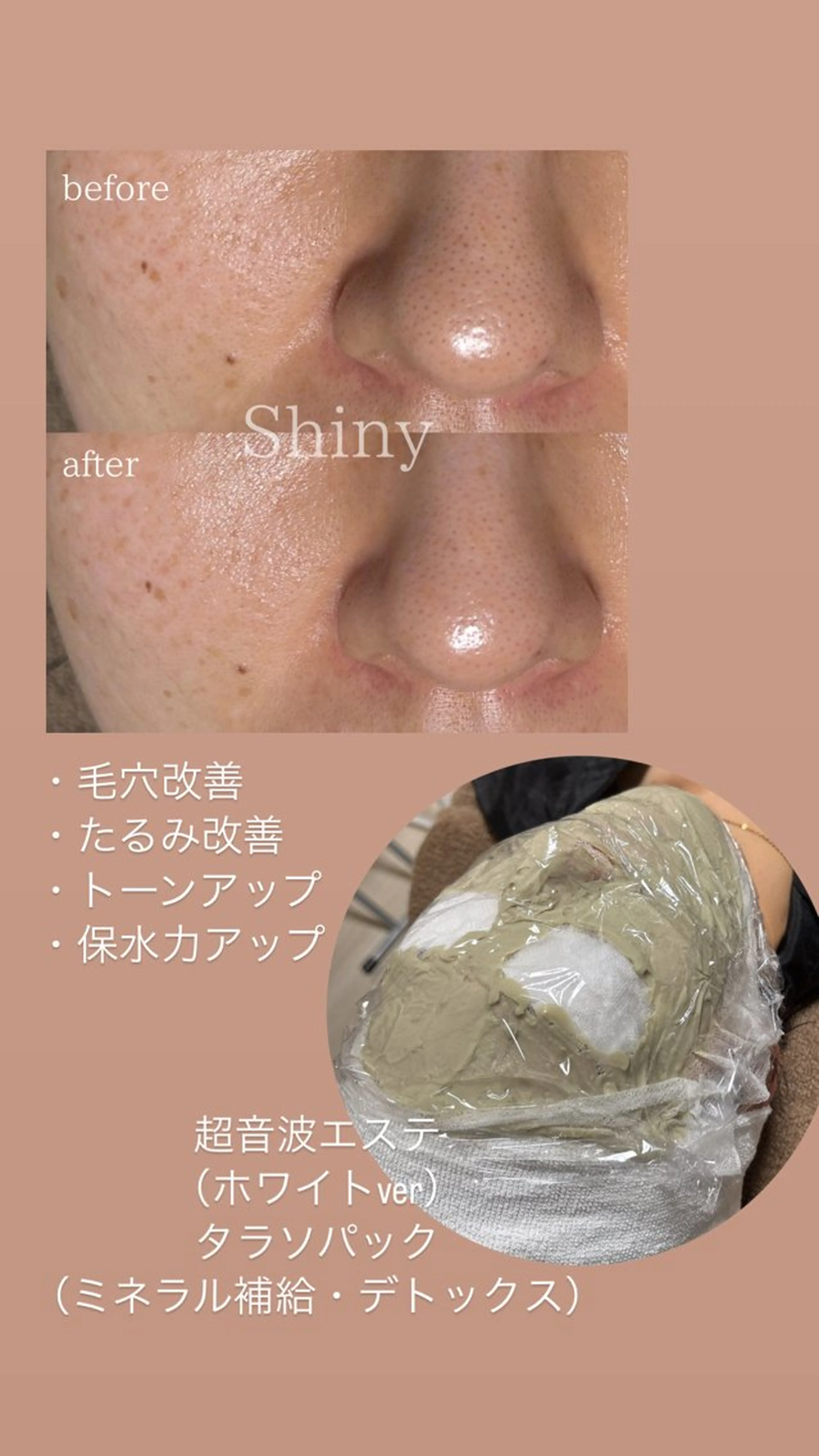 エステ Shiny所属・✨ナリス化粧品✨ Shinyのエステ・リラクイメージ