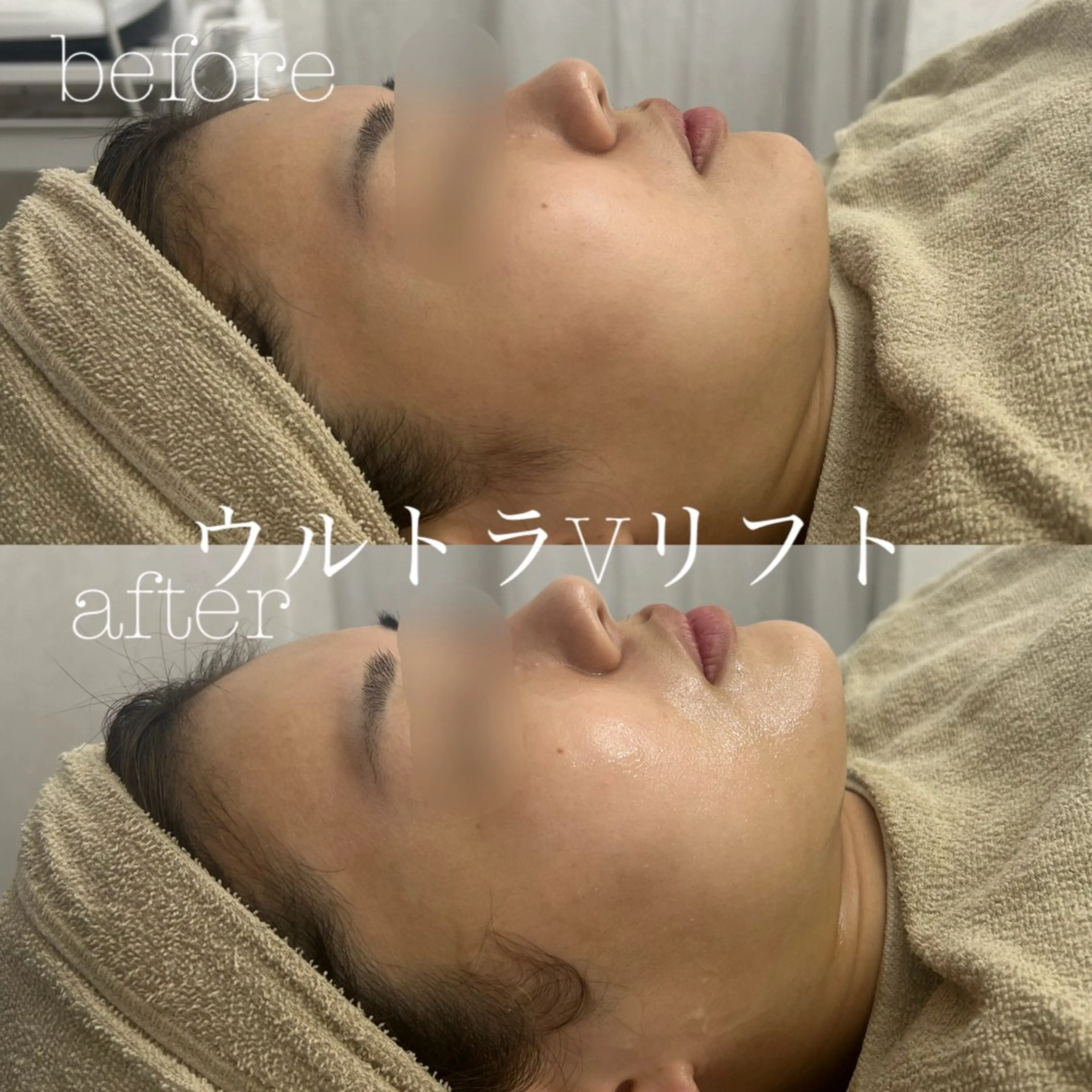 メンズ エステ フェイシャルサロン CHIARA 荒田のエステ・リラクイメージ