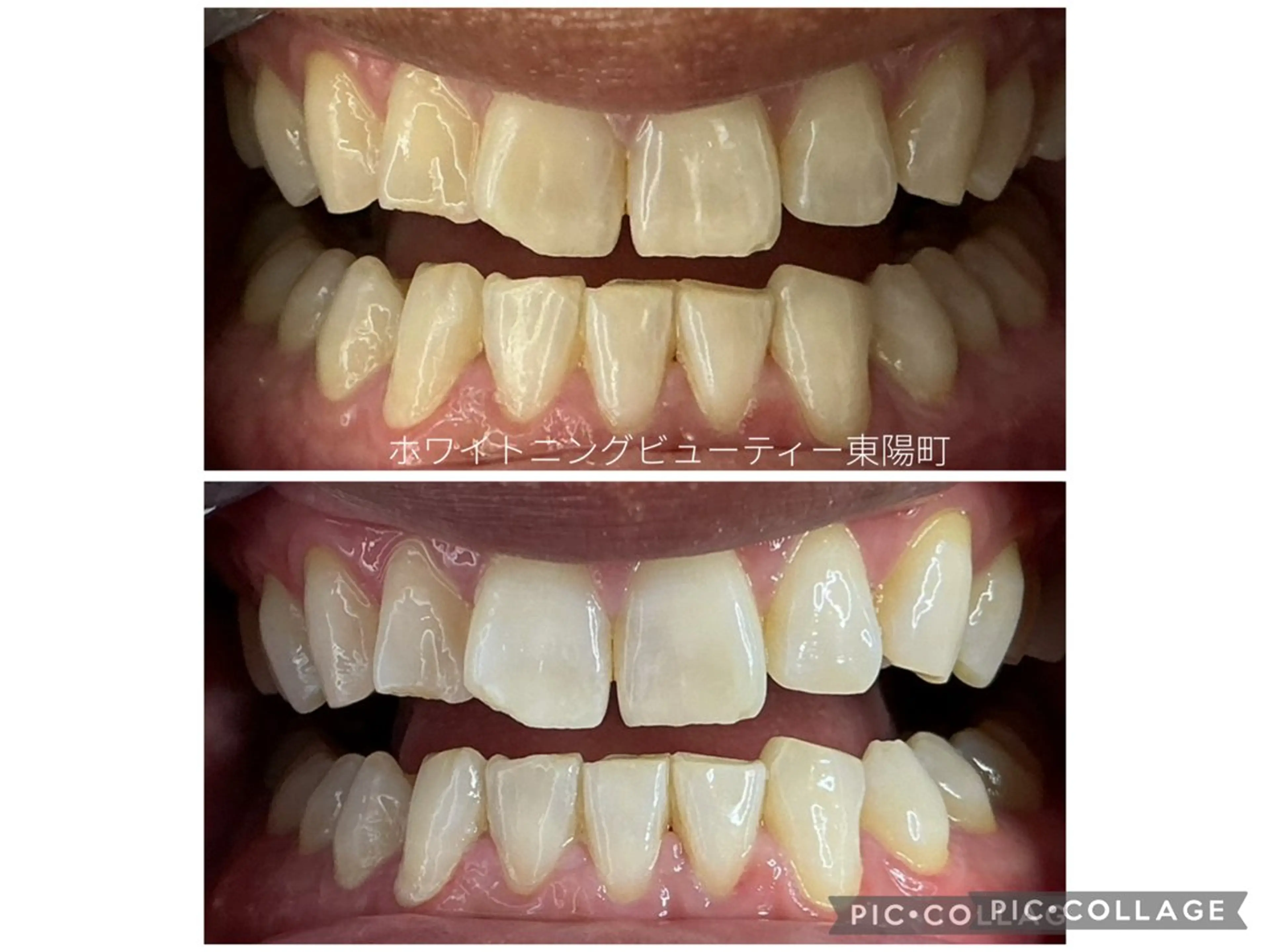 その他 ホワイトニングビューティー東陽町店所属・ホワイトニング ビューティー東陽町店のその他イメージ
