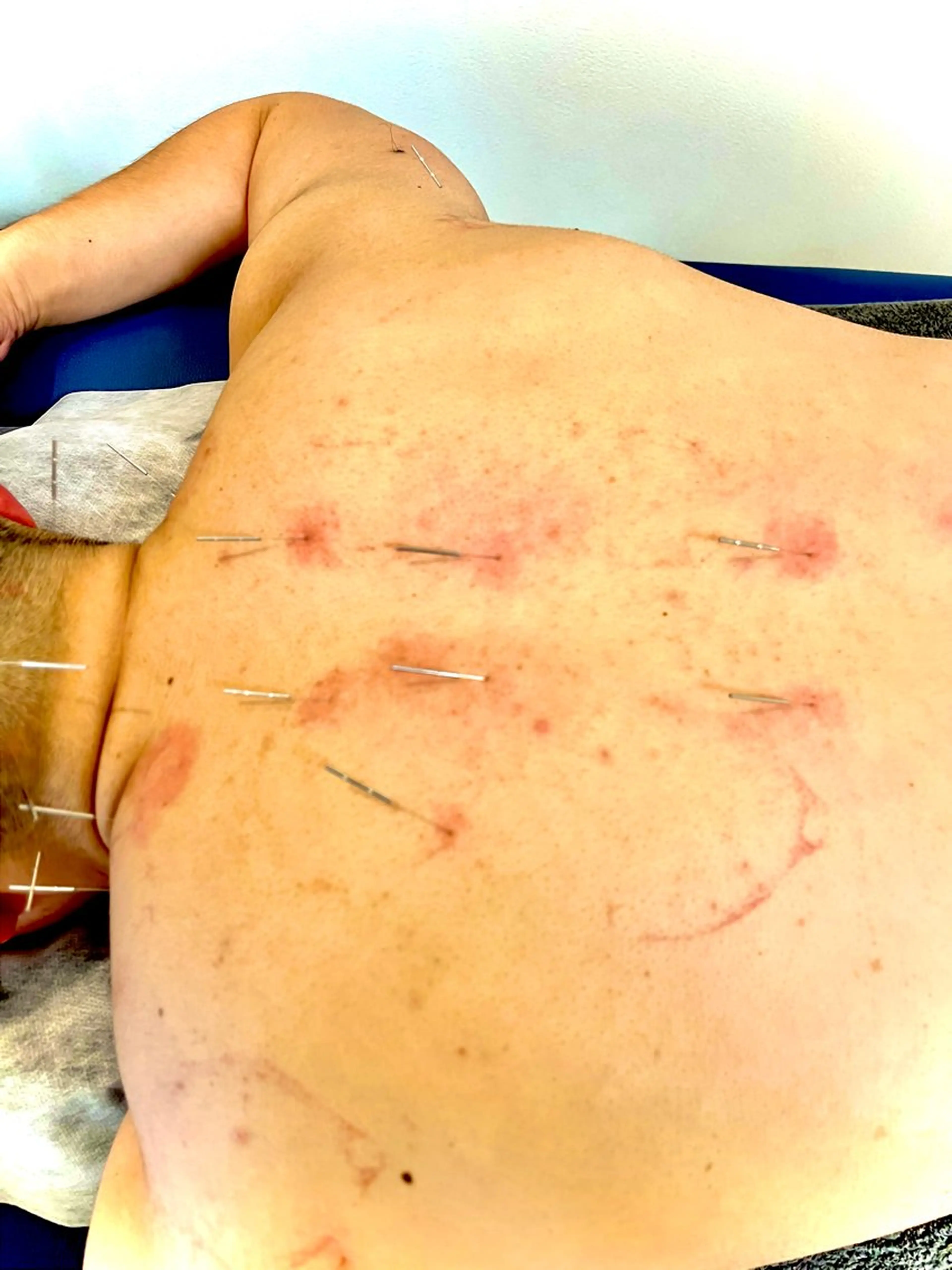 リラク 【鍼灸サロン　にった】所属・はりきゅう整体 新田鍼灸院のエステ・リラクイメージ