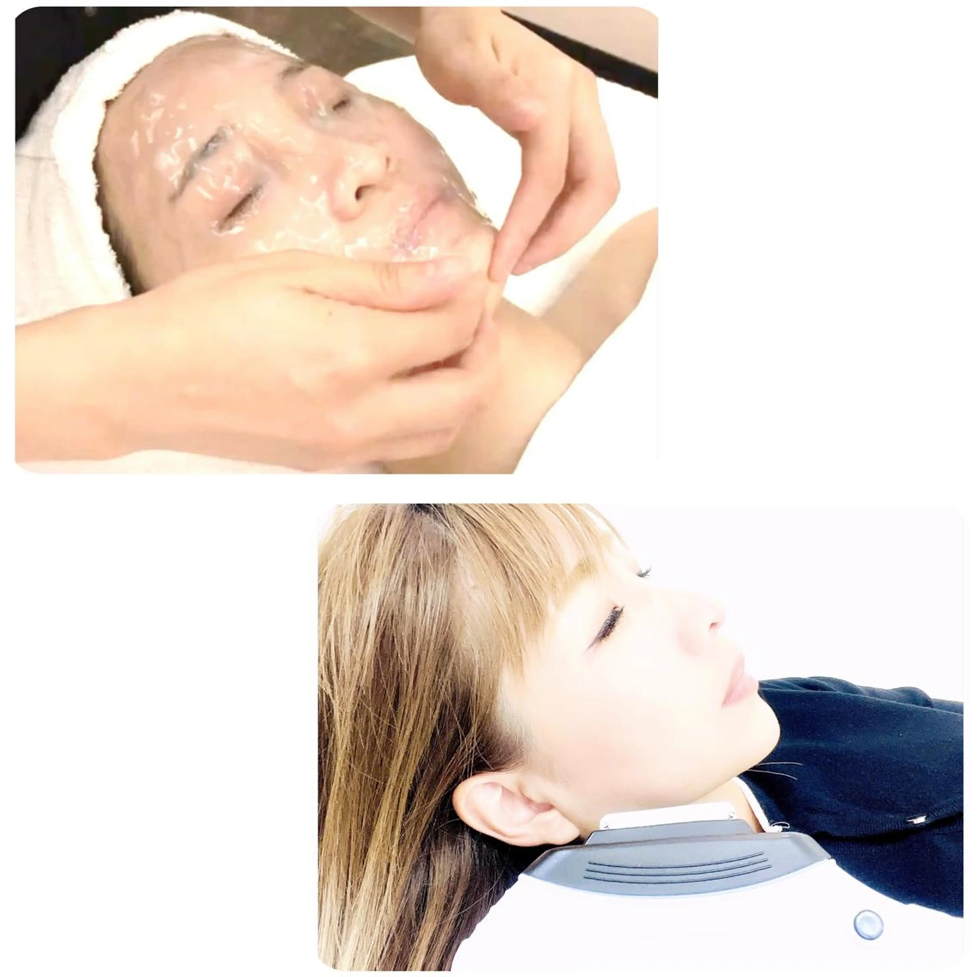 光フェイシャル+高濃度炭酸パックの写真