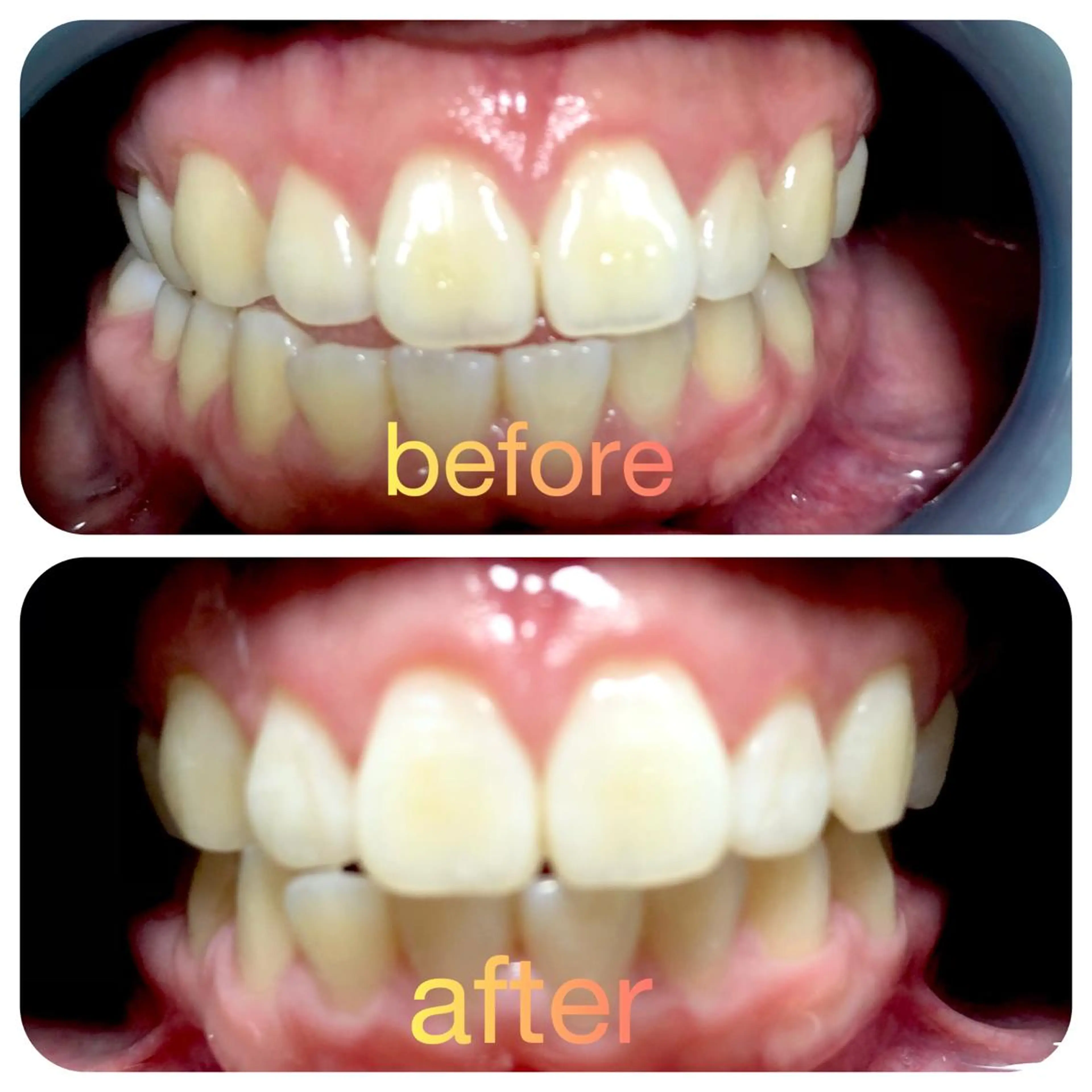 その他 two nailのネイルデザイン