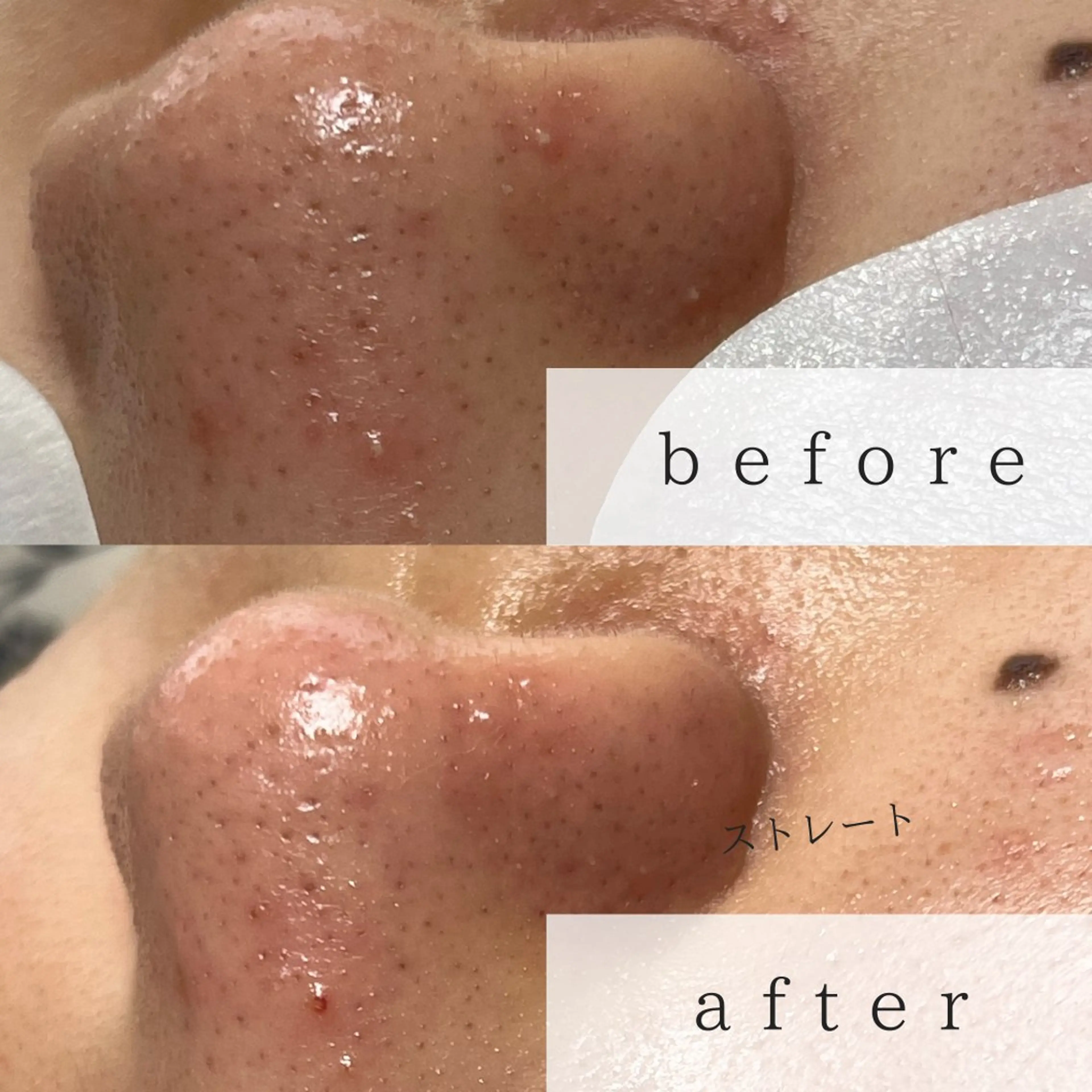 yokohama 🎀miaのマツエク・マツパデザイン