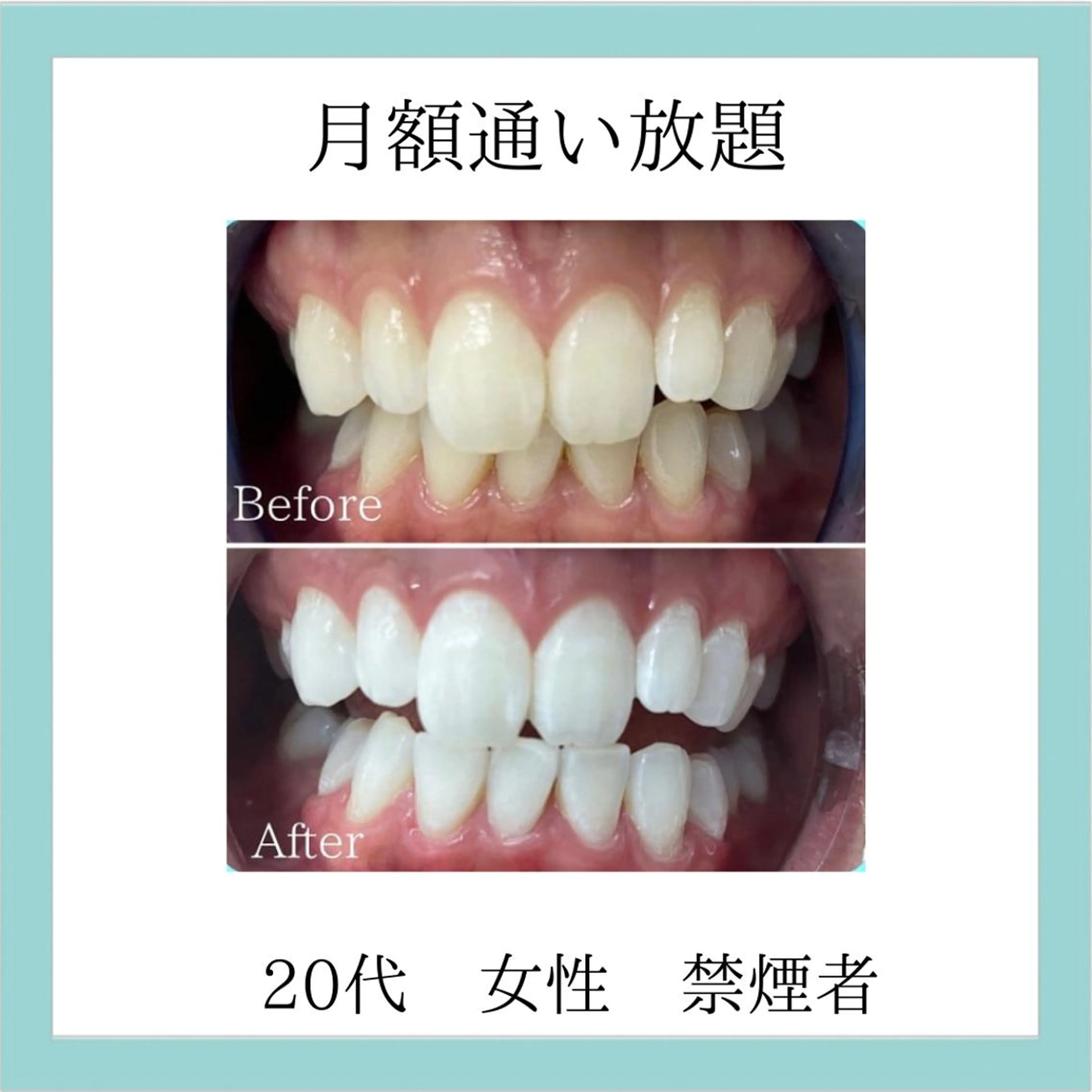 メンズ その他 ホワイトニング専門店 WHITE天神店のエステ・リラクイメージ