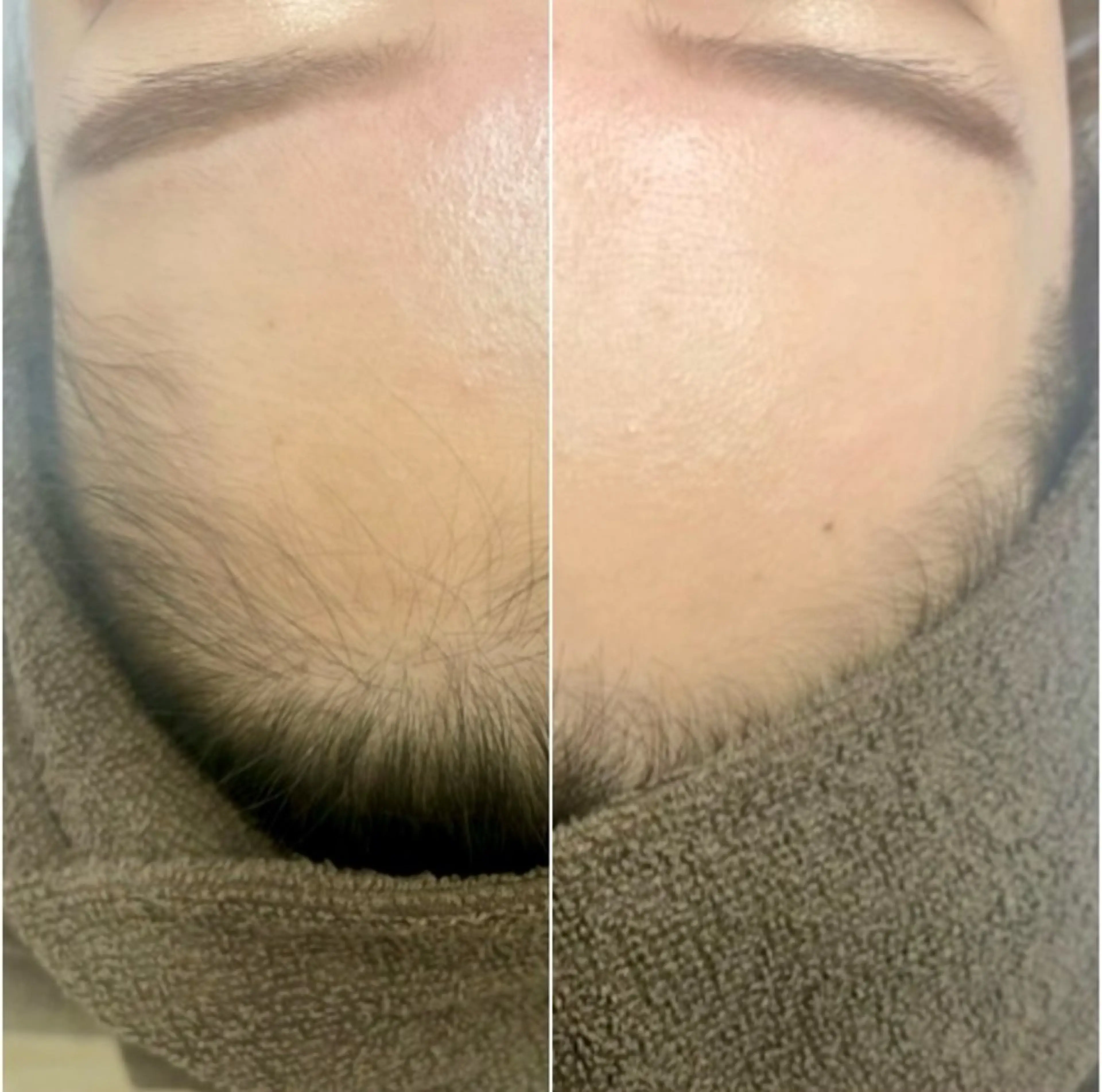 脱毛サロンLULA 恵比寿店　笠松のエステ・リラクイメージ