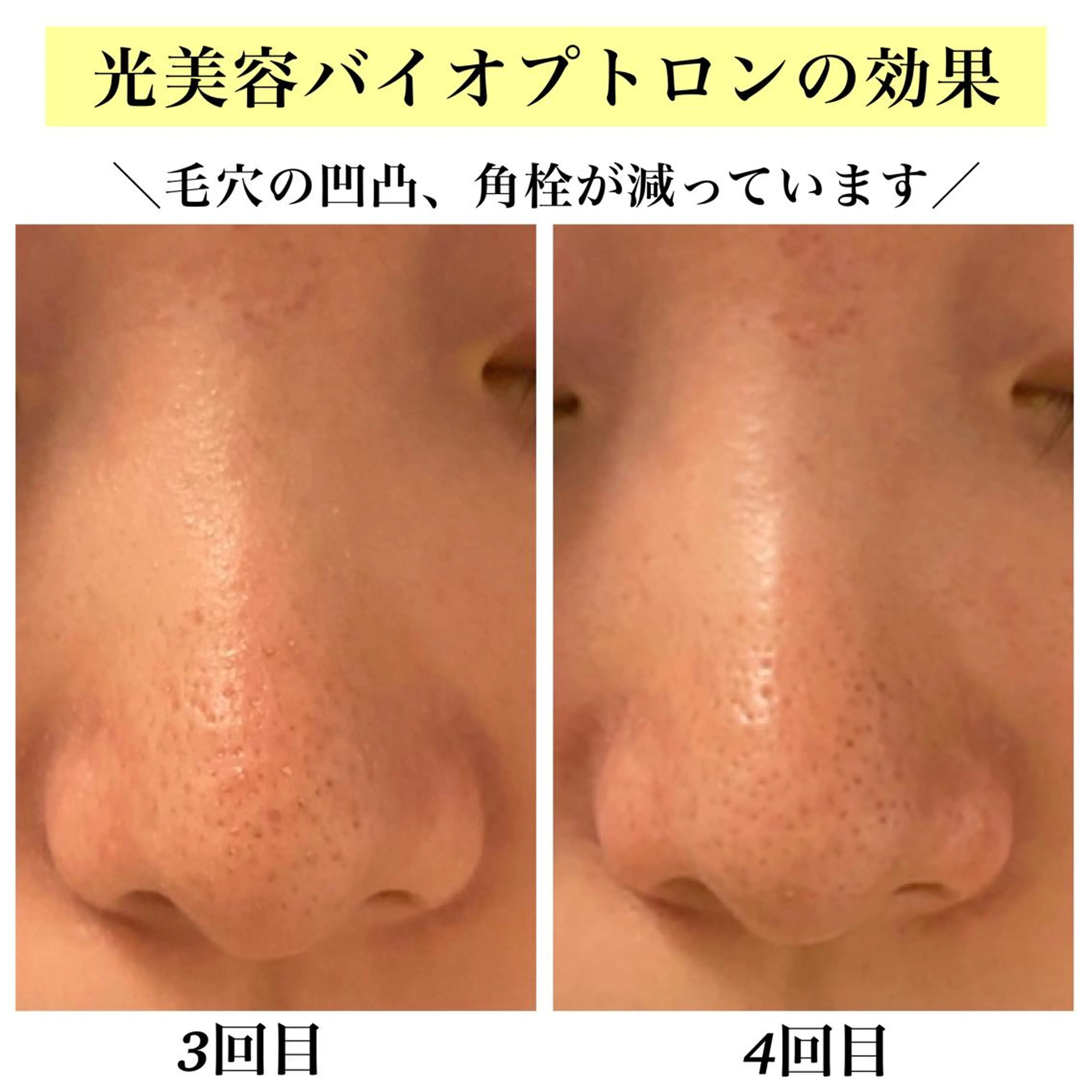 Bellesthe （ベルエステ）のエステ・リラクイメージ