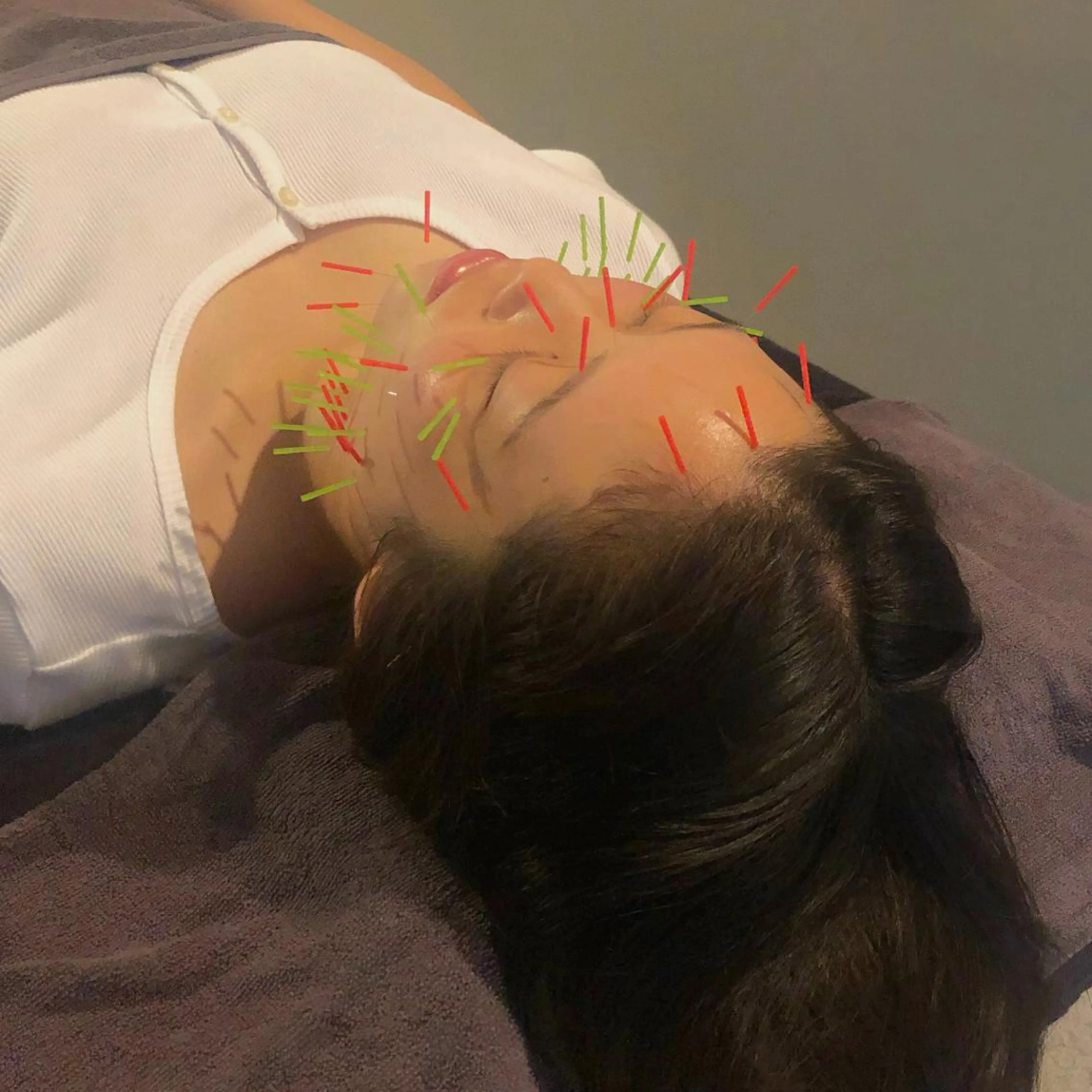 エステ リラク 美容鍼灸整体サロンBeAu所属・美容鍼灸師 川口 愛華のエステ・リラクイメージ