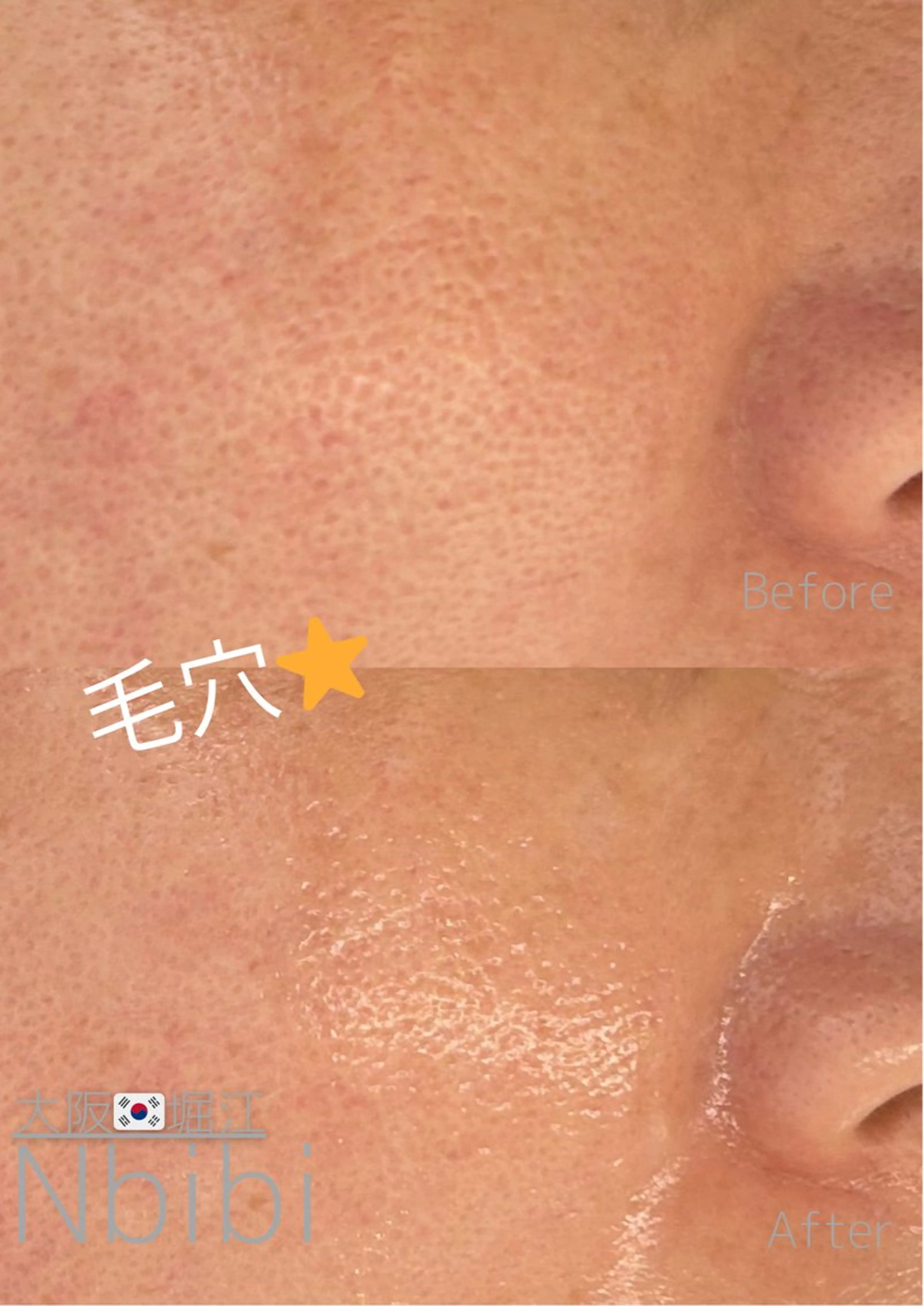 エステ 韓国🇰🇷価格 サロン_Nbibiのエステ・リラクイメージ