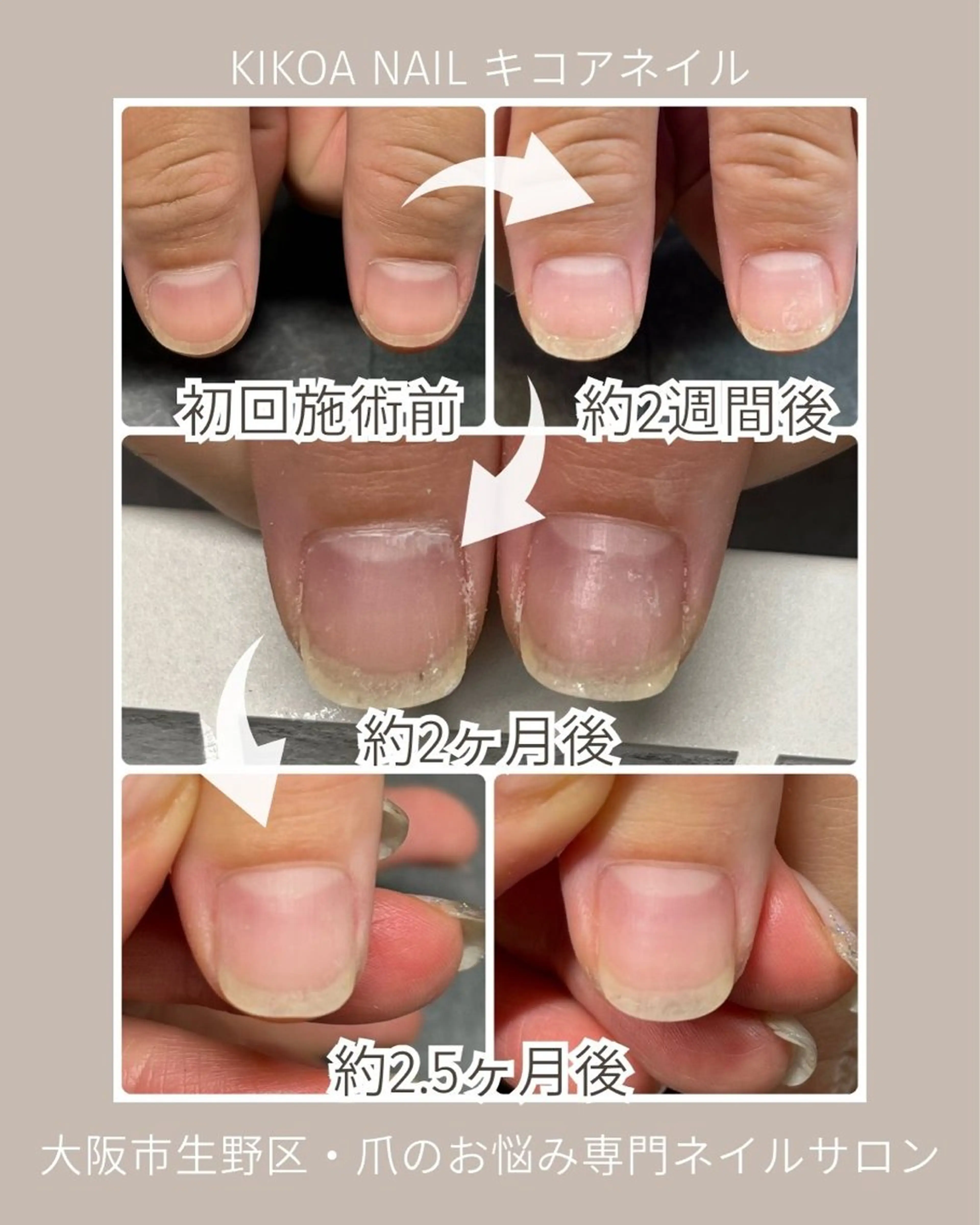 ネイル KIKOA NAIL キコアネイルのネイルデザイン