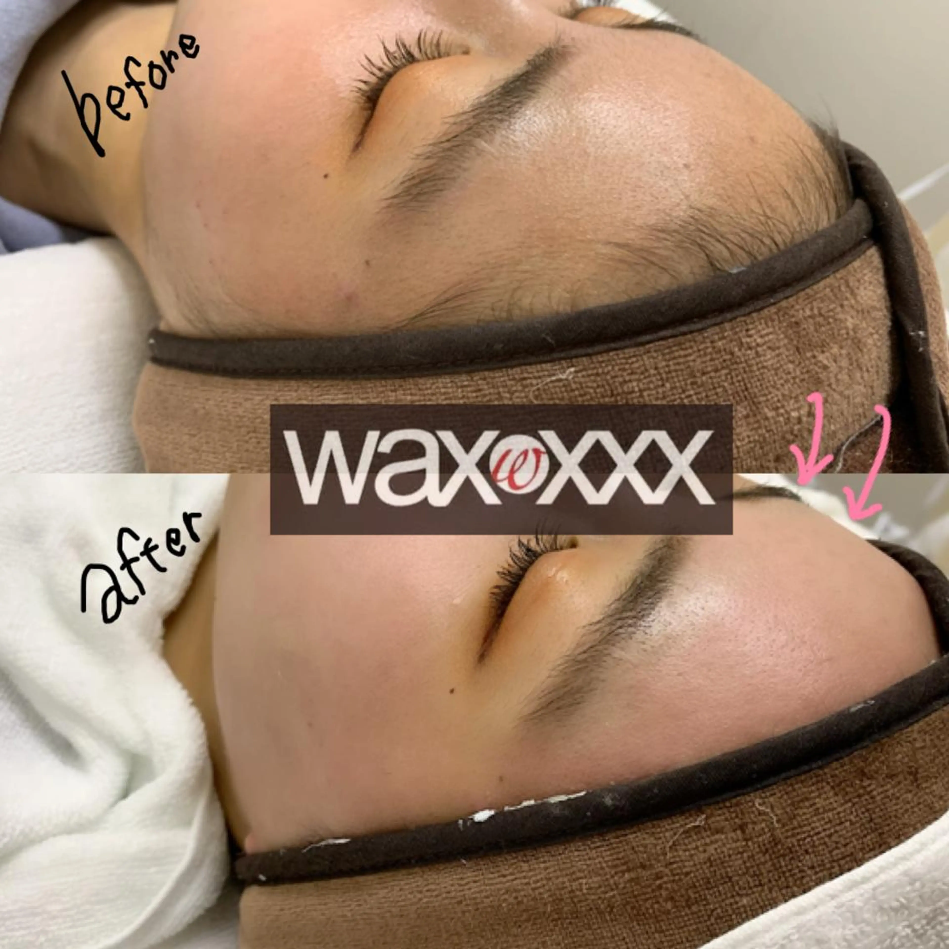 【フェイスwax脱毛】waxxxx🌈の写真
