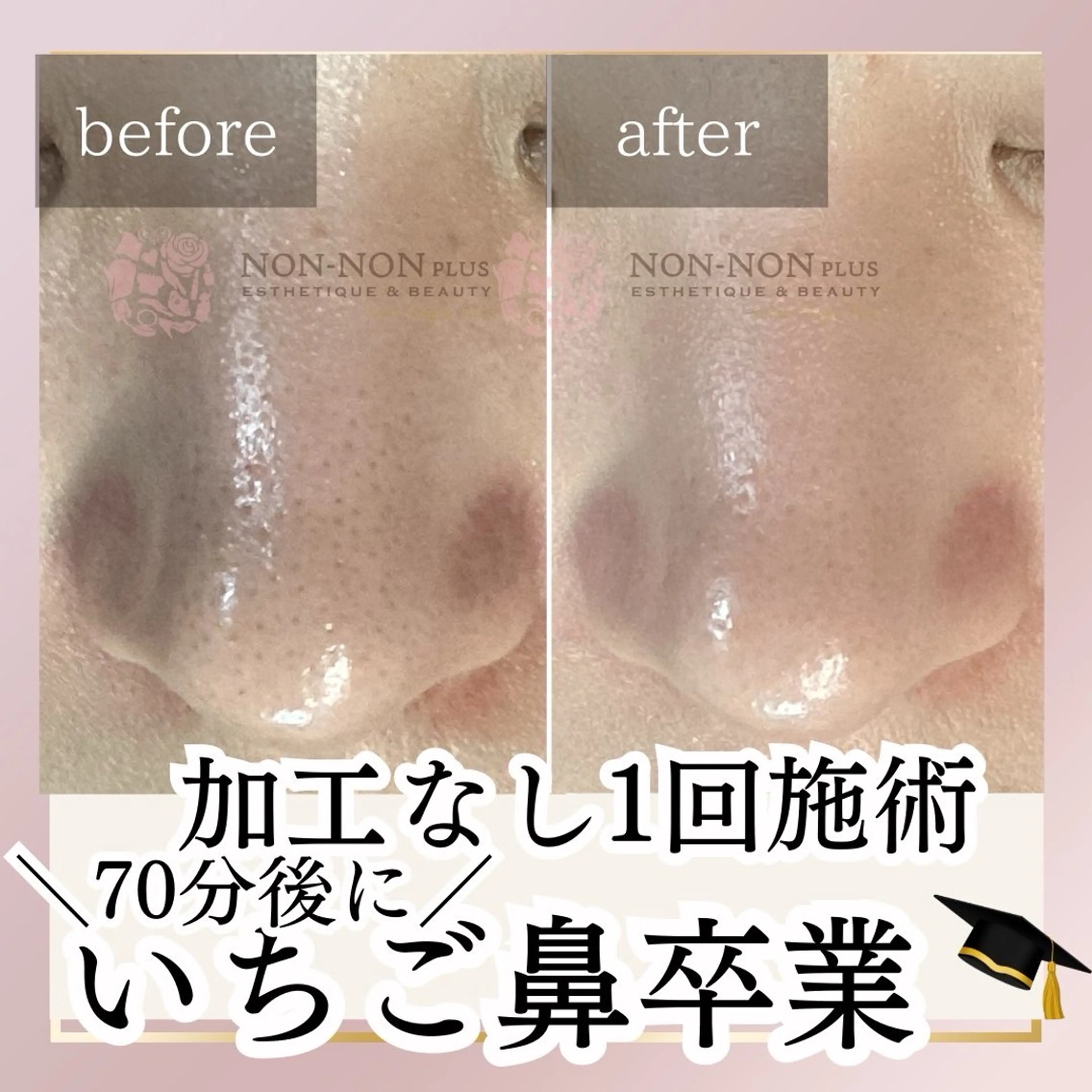 NON-NONプラス 博多のエステ・リラクイメージ