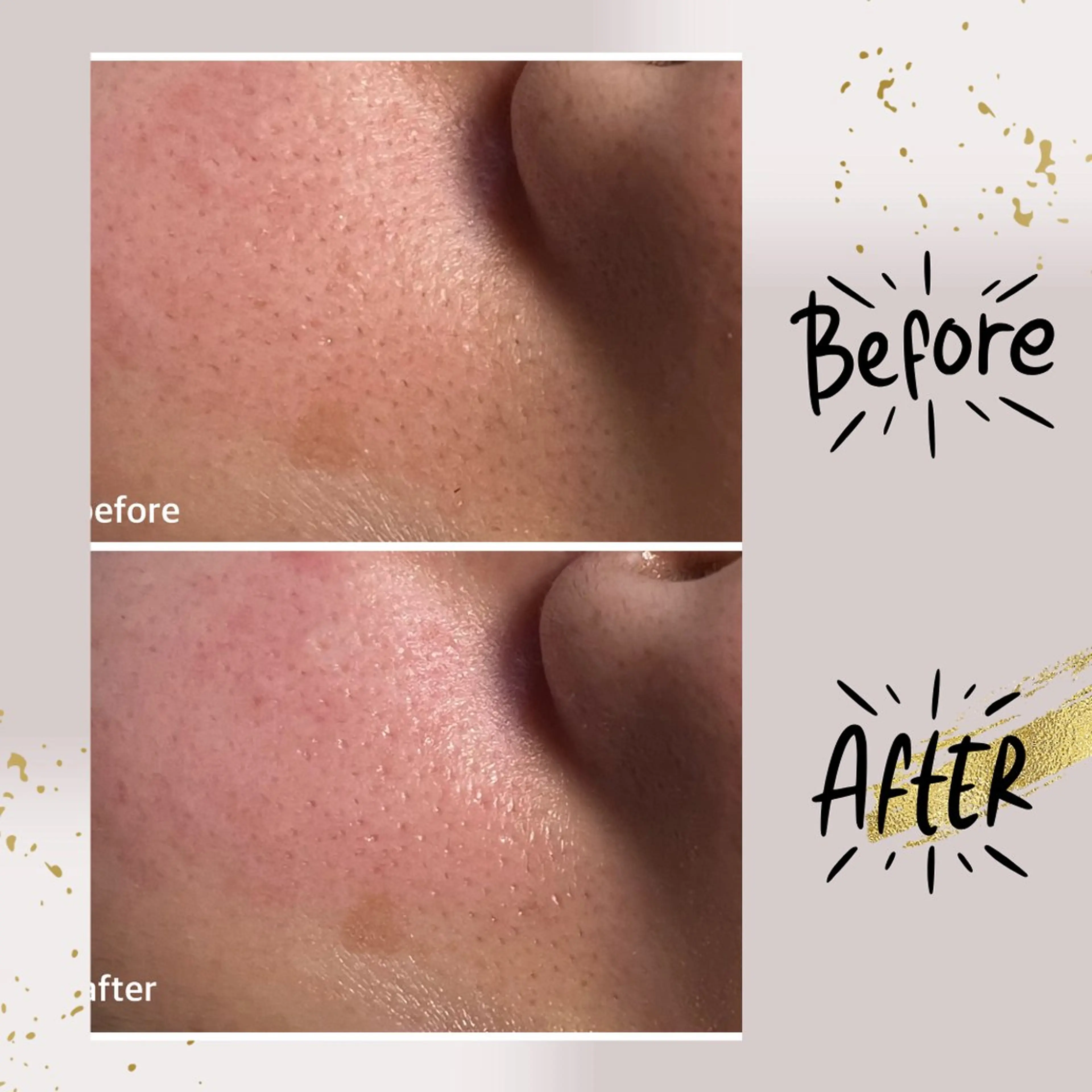 エステ リラク ピーリング専門店 Belluteのエステ・リラクイメージ