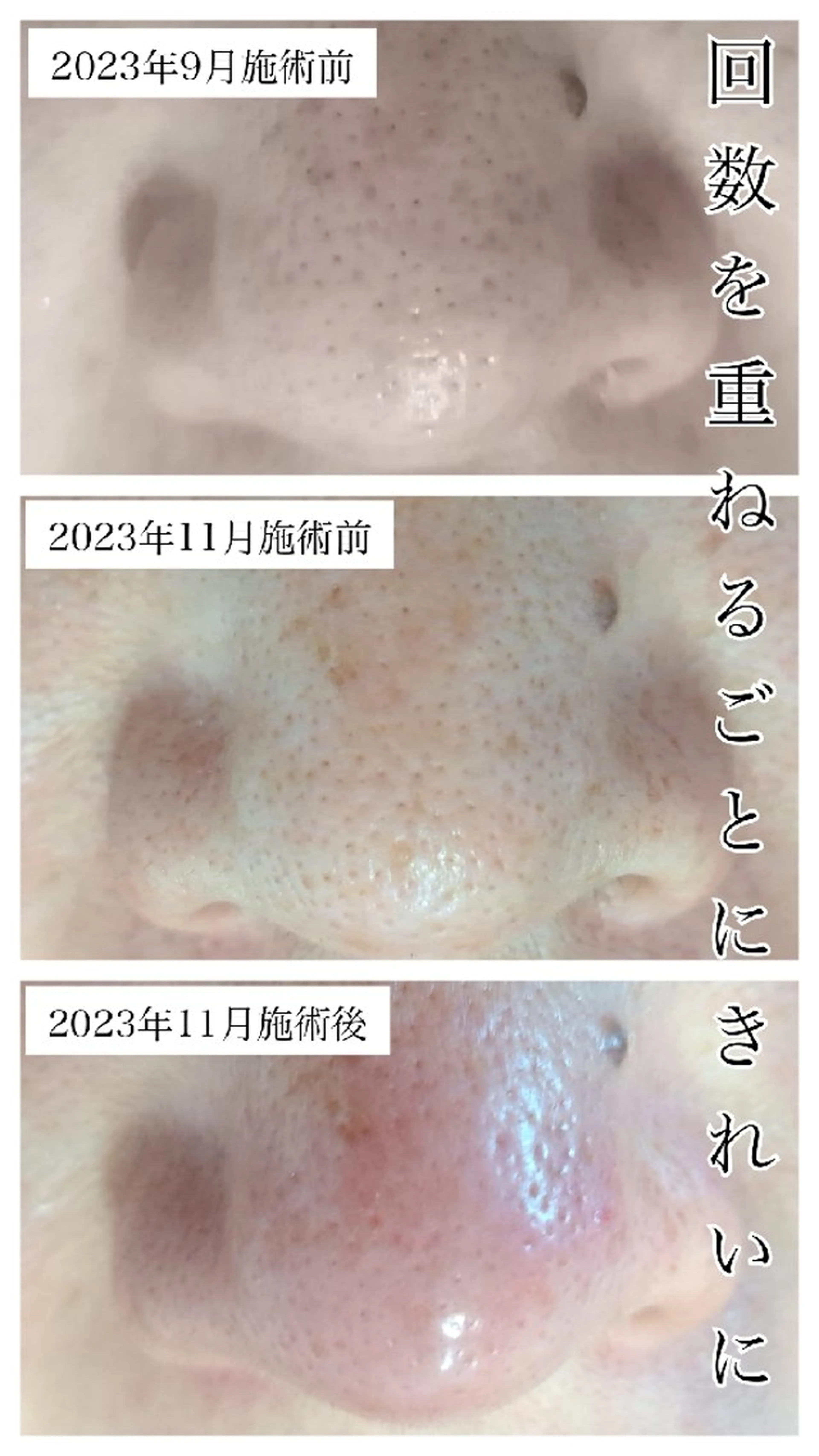 美肌脱毛サロン つるりと御殿場店所属・美肌脱毛サロン つるりとのその他イメージ